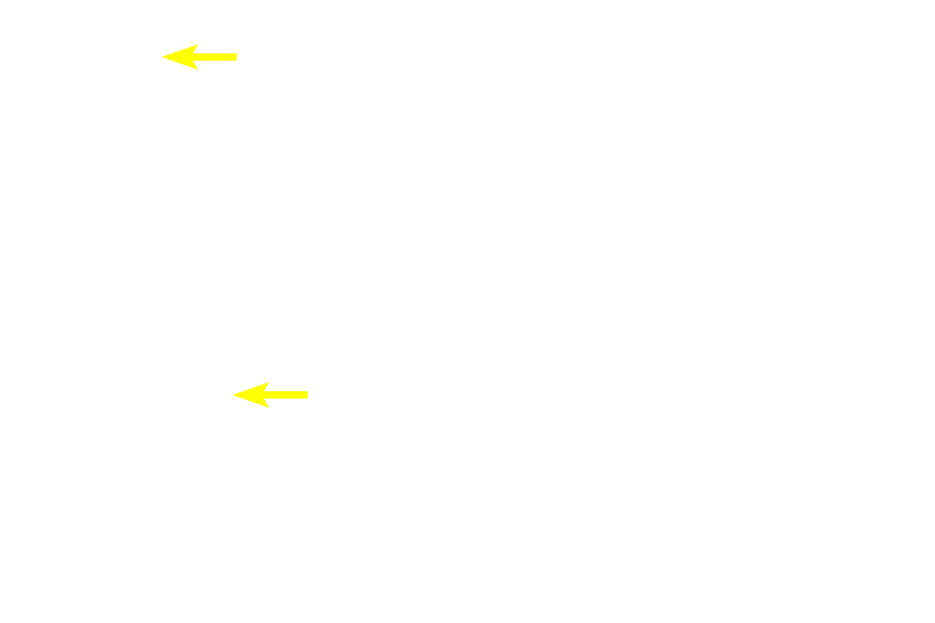 Intralobular ducts <p>A lobule of a compound tubuloacinar gland displays both elongated, mucus-secreting tubules and spherical, serous-secreting acini.  Intralobular ducts are also visible.  This gland is the submandibular (submaxillary) salivary gland and the saliva it secretes contains both mucus and serous components.  400x</p>
