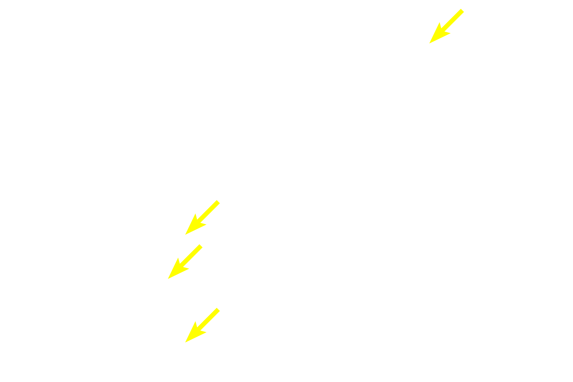 Serous-secreting acini <p>Mucus-secreting cells are easily distinguished from those releasing a serous product. Mucous cells are frothy in appearance and are arranged as tubules with wide lumens.  Serous-secreting cells can be arranged as acini or as serous demilunes. Each acinus has a small lumen surrounded by wedge-shaped cells with secretory granules.  Serous demilunes possess similar cells, but they are configured as crescent-shaped units capping the ends of tubules.  Submandibular  1000x</p>
