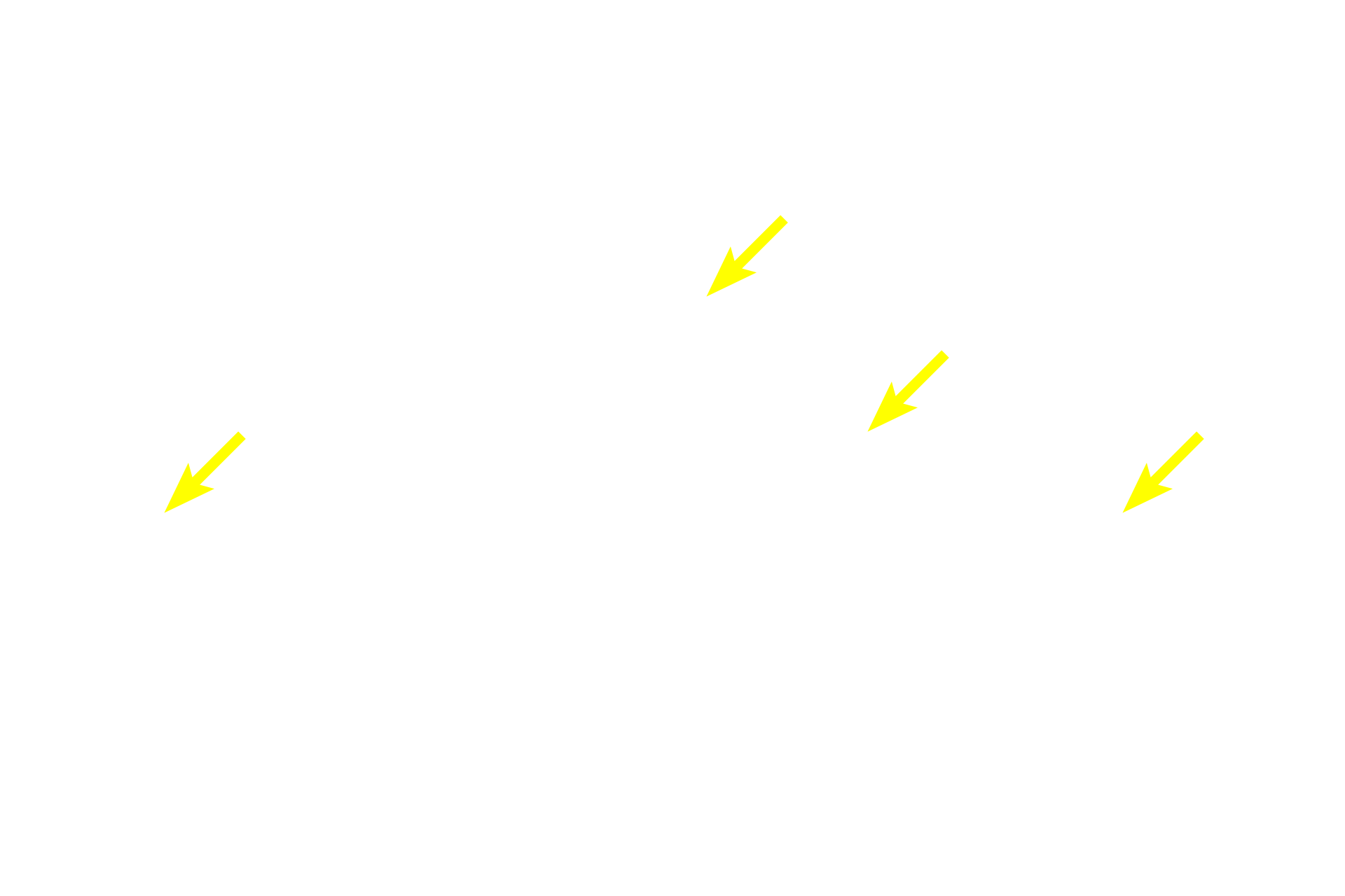 Mucus-secreting tubules <p>Mucus-secreting cells are easily distinguished from those releasing a serous product. Mucous cells are frothy in appearance and are arranged as tubules with wide lumens.  Serous-secreting cells can be arranged as acini or as serous demilunes. Each acinus has a small lumen surrounded by wedge-shaped cells with secretory granules.  Serous demilunes possess similar cells, but they are configured as crescent-shaped units capping the ends of tubules.  Submandibular  1000x</p>
