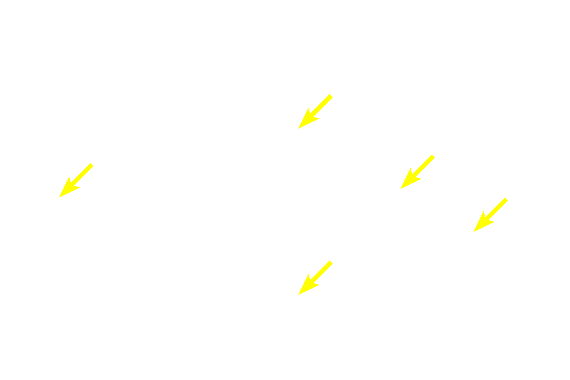  - Mucin <p>Mucus-secreting cells are easily distinguished from those releasing a serous product. Mucous cells are frothy in appearance and are arranged as tubules with wide lumens.  Serous-secreting cells can be arranged as acini or as serous demilunes. Each acinus has a small lumen surrounded by wedge-shaped cells with secretory granules.  Serous demilunes possess similar cells, but they are configured as crescent-shaped units capping the ends of tubules.  Submandibular  1000x</p>
