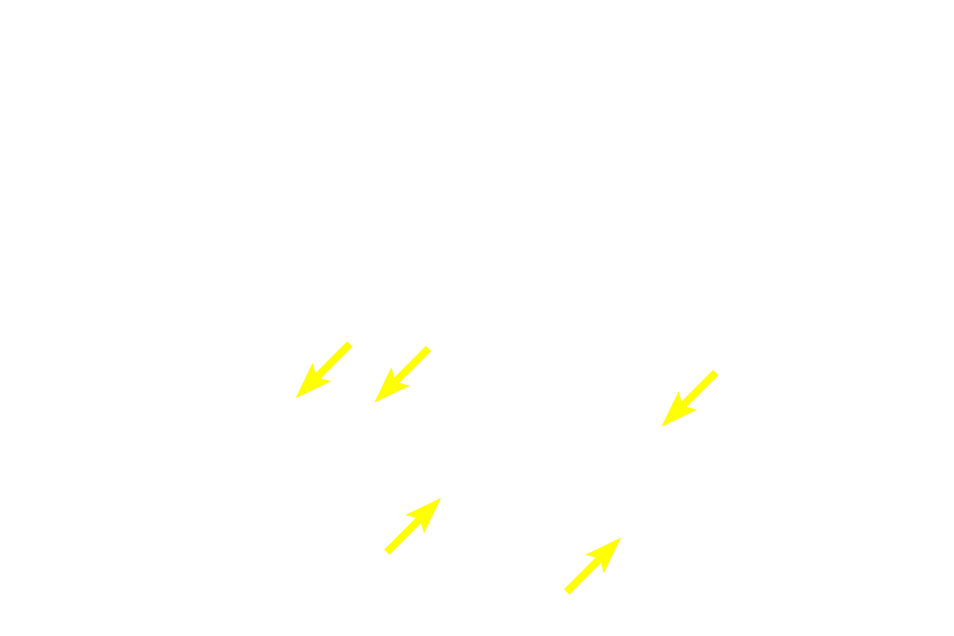  - Nuclei of mucous cells <p>The morphology of serous and mucous secretory units is demonstrated in this image.  Each serous unit is acinar with a narrow lumen and contains cells with secretory granules and spherical nuclei.  Each mucous unit is tubular with a wide lumen.  The secretory cells appear vacuolated, with nuclei flattened at the base of the cell.  Submandibular gland  1000x</p>
