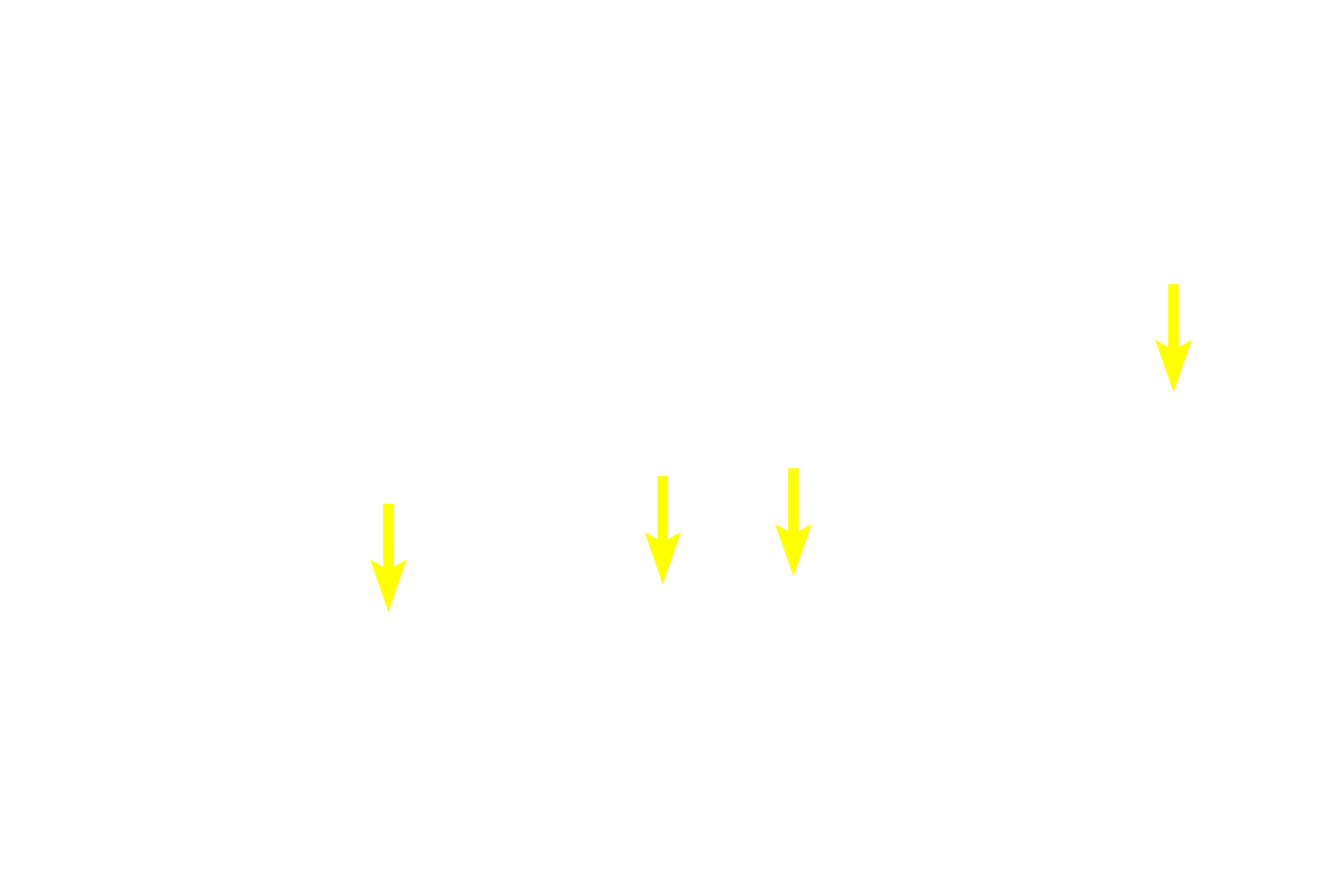  - Mucin granules <p>The morphology of serous and mucous secretory units is demonstrated in this image.  Each serous unit is acinar with a narrow lumen and contains cells with secretory granules and spherical nuclei.  Each mucous unit is tubular with a wide lumen.  The secretory cells appear vacuolated, with nuclei flattened at the base of the cell.  Submandibular gland  1000x</p>
