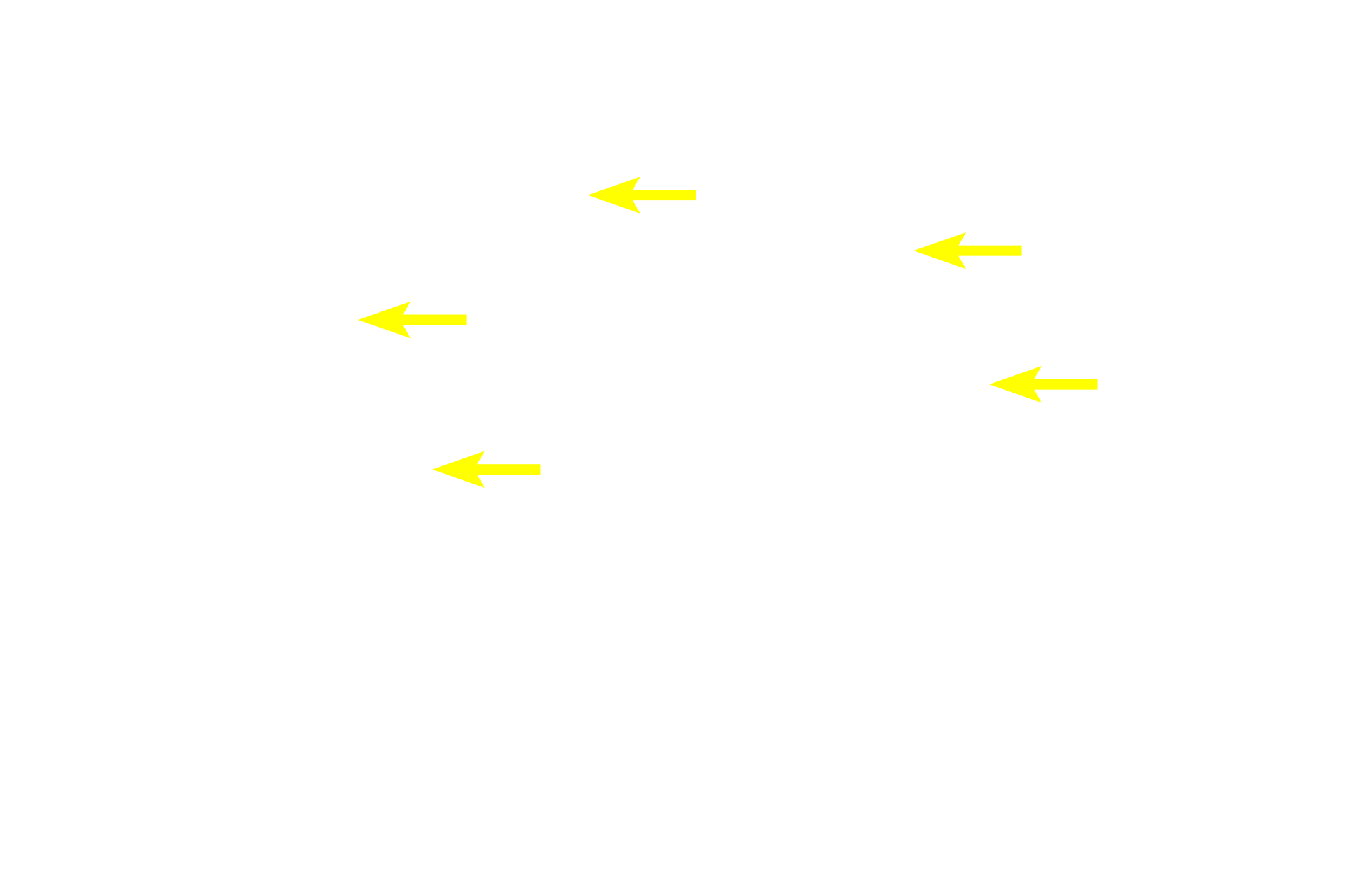  - Secretory granules <p>The morphology of serous and mucous secretory units is demonstrated in this image.  Each serous unit is acinar with a narrow lumen and contains cells with secretory granules and spherical nuclei.  Each mucous unit is tubular with a wide lumen.  The secretory cells appear vacuolated, with nuclei flattened at the base of the cell.  Submandibular gland  1000x</p>
