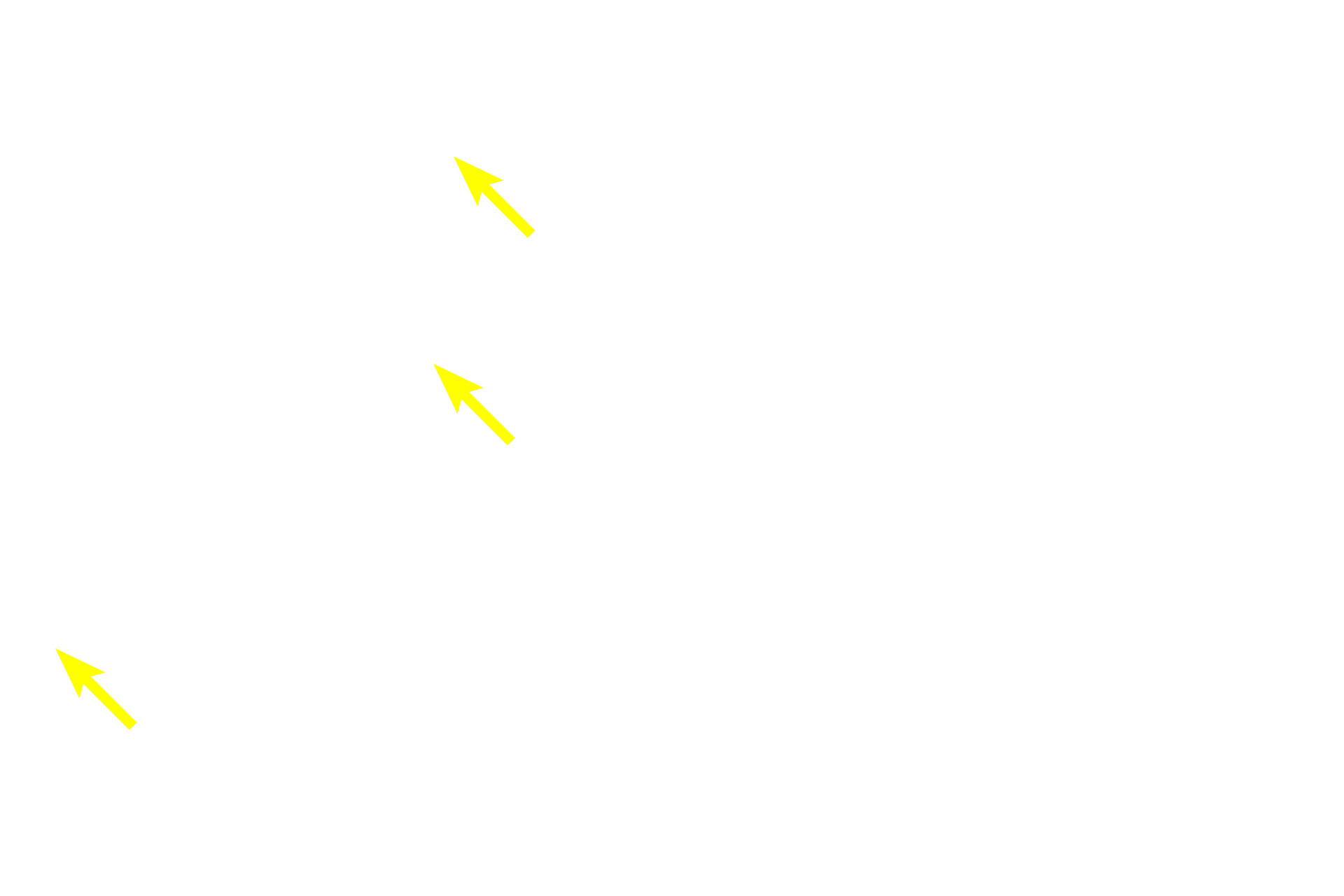  - Acinar cell nuclei <p>Acinar cells are the source of the watery component of saliva, which contains a number of enzymes and electrolytes.  Acinar cell cytoplasm is filled with well-defined secretory (zymogen) granules and the nucleus is generally circular or oval-shaped.  The watery secretion does not require a wide lumen for release.</p>
