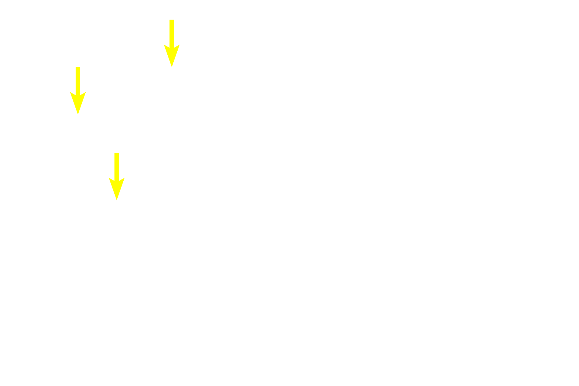  - Acinar cells <p>Acinar cells are the source of the watery component of saliva, which contains a number of enzymes and electrolytes.  Acinar cell cytoplasm is filled with well-defined secretory (zymogen) granules and the nucleus is generally circular or oval-shaped.  The watery secretion does not require a wide lumen for release.</p>

