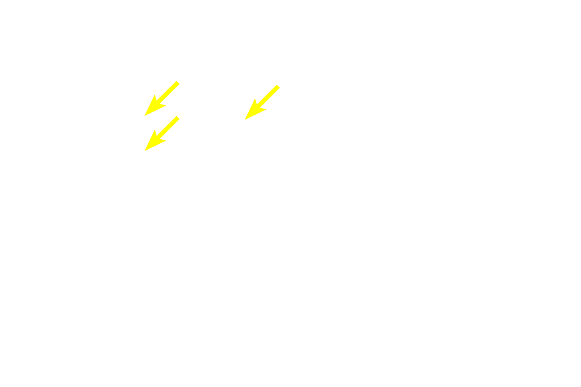  - Secretory granules <p>Acinar cells are the source of the watery component of saliva, which contains a number of enzymes and electrolytes.  Acinar cell cytoplasm is filled with well-defined secretory (zymogen) granules and the nucleus is generally circular or oval-shaped.  The watery secretion does not require a wide lumen for release.</p>
