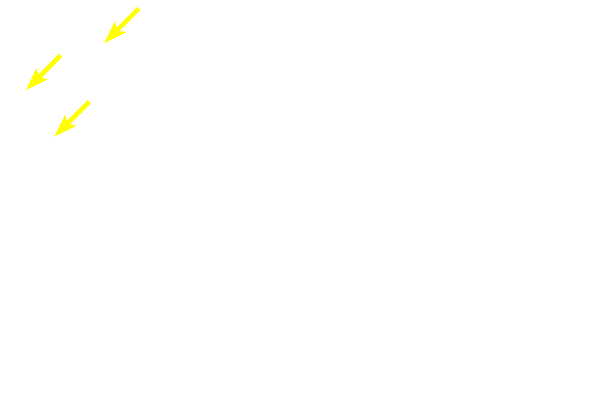Serous acini <p>In this compound tubuloacinar gland the mucus-secreting tubules far outnumber serous acini.  Serous acini are less numerous, and many serous-secreting cells are located in serous demilunes.  Sublingual gland  100x</p>
