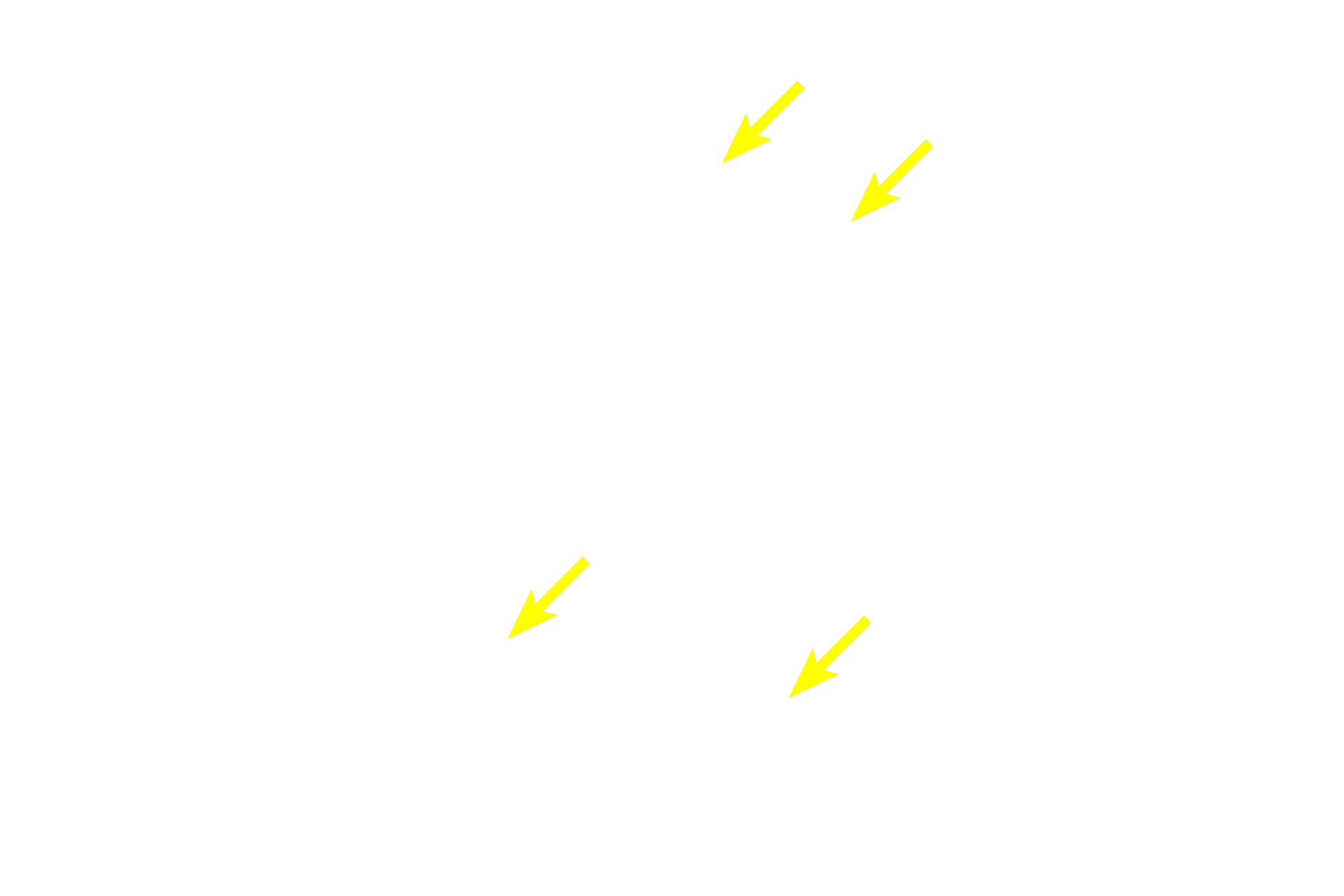 Intralobular ducts <p>In this compound tubuloacinar gland the mucus-secreting tubules far outnumber serous acini.  Serous acini are less numerous, and many serous-secreting cells are located in serous demilunes.  Sublingual gland  100x</p>
