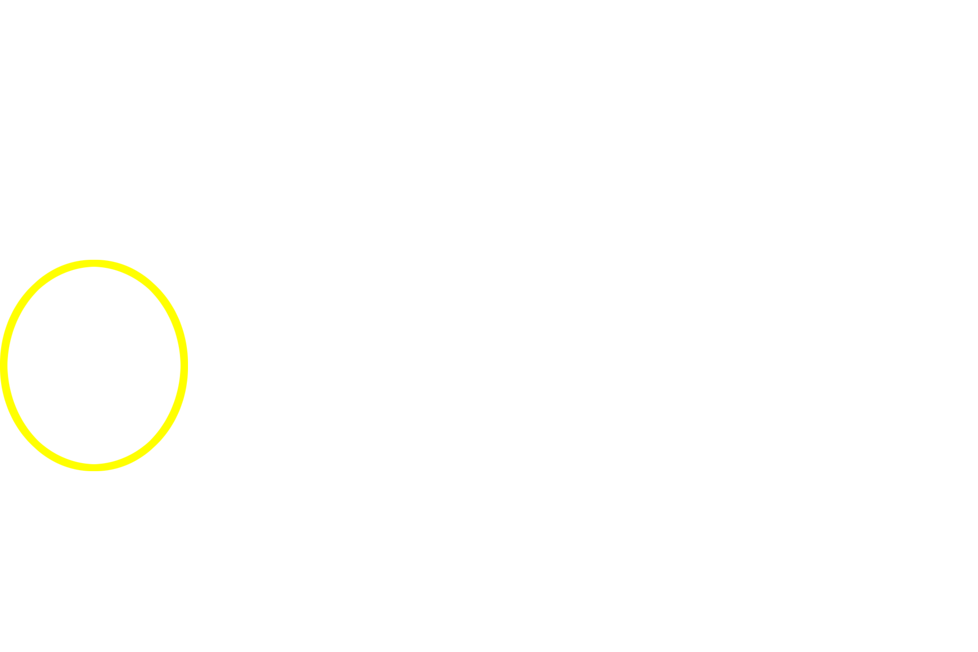Intralobular duct <p>This salivary gland is primarily a mucus-secreting gland, with only small areas dedicated to serous secretion.  The well developed tubules display wide lumens and cells with basally located nuclei and foamy cytoplasm.  A portion of an intralobular duct is also visible.  Sublingual gland 400x</p>
