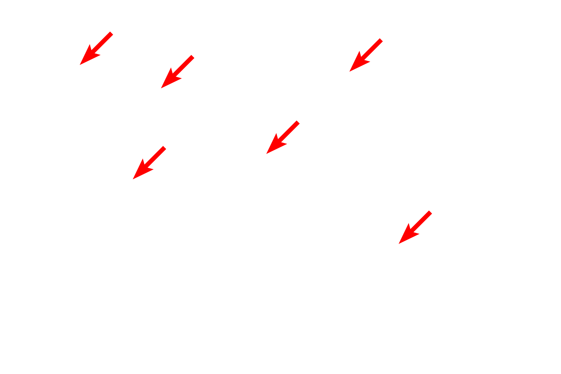 Mucin granules <p>The presence of mucin granules in the cells of this mucus-secreting tubule accounts for their foamy appearance seen with the light microscope.  The granules contain mucin proteins which become hydrated to form mucus after their release.  Trachea  5000x</p>
