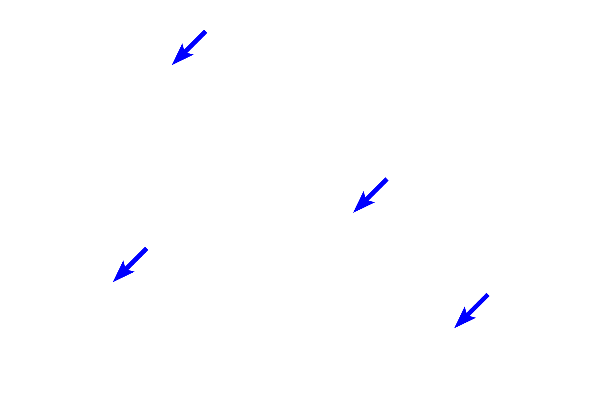 Interlobular connective tissue <p>A compound acinar gland is subdivided by connective tissue septa into lobules consisting of secretory units, intralobular ducts and intralobular connective tissue.  In this parotid salivary gland, the secretory units consist entirely of secretory acini (alveoli) secreting a serous product.</p>
