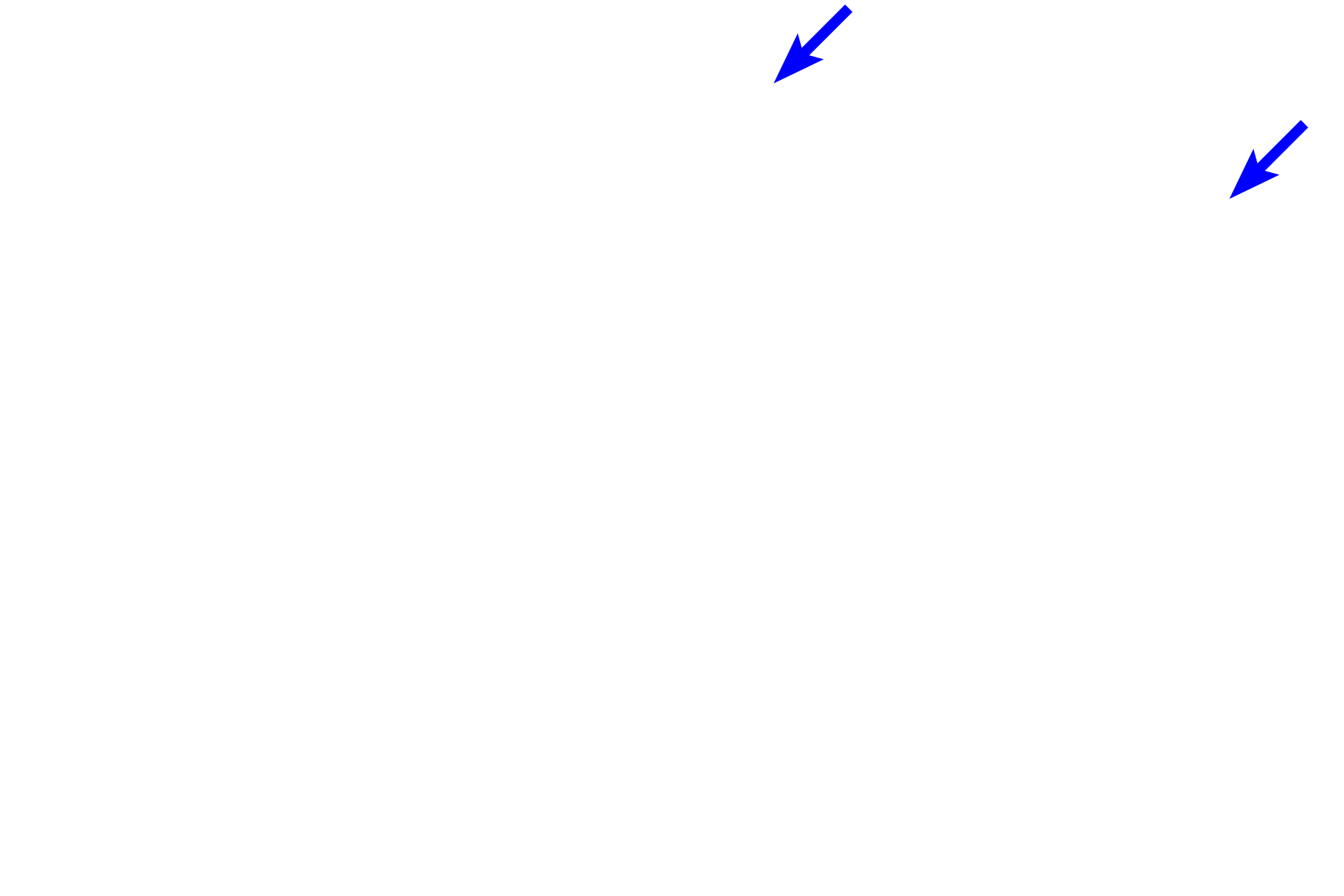 Interlobular connective tissue <p>This portion of a single lobule consists entirely of acini.  The ducts draining the acini gradually increase in diameter and their lining epithelia gently transition from low cuboidal to columnar.  These ducts, called intralobular, are located within the lobule, surrounded by secretory they units.  They join to form interlobular ducts that exit the lobule surrounded by connective tissue and are lined by a stratified columnar epithelium.  100x</p>
