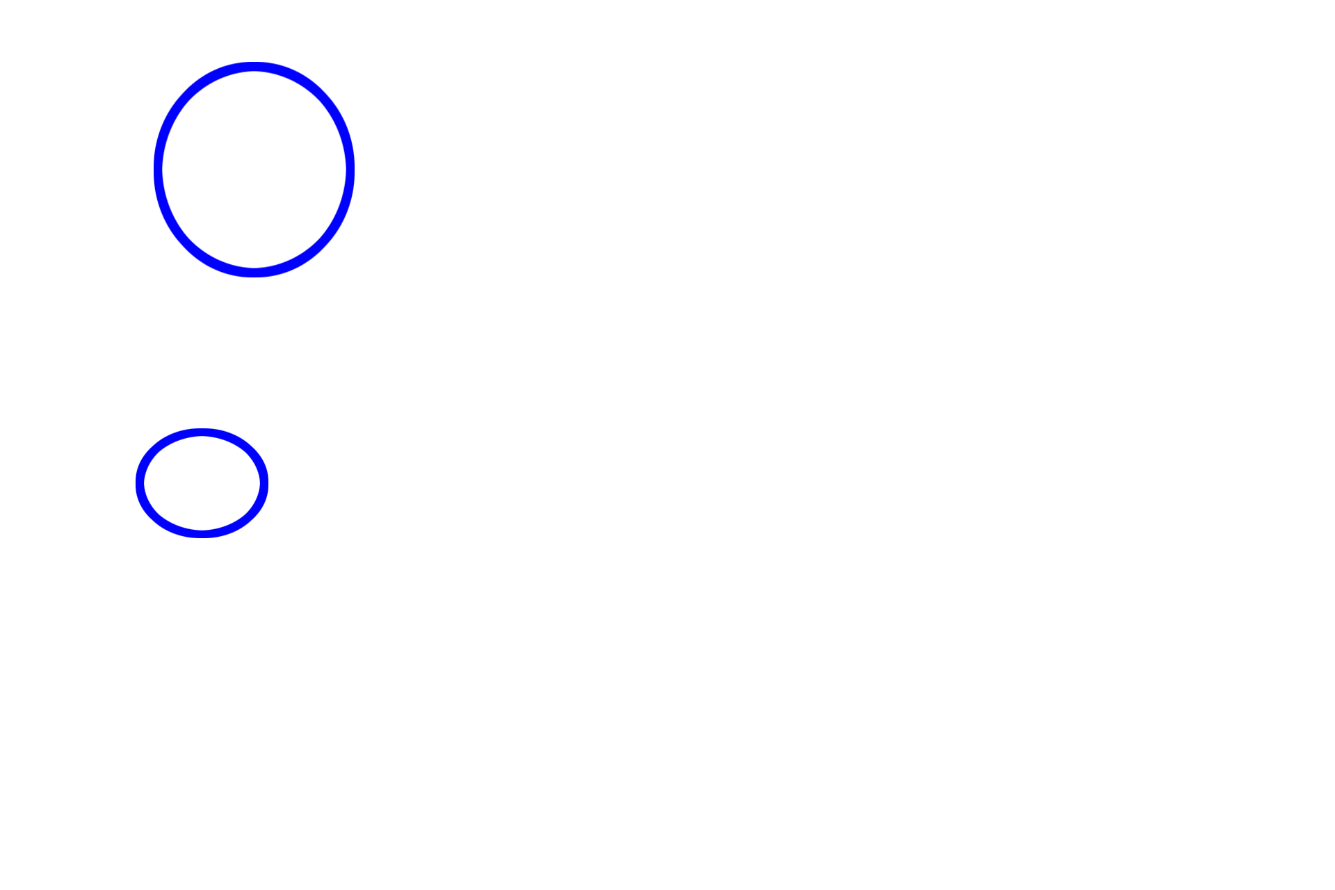 Interlobular ducts <p>Intralobular ducts are surrounded by glandular parenchyma and are lined by a cuboidal or columnar epithelium.  Interlobular ducts are lined by a stratified columnar epithelium and anastomose with each other to form the main duct(s) connecting to the epithelium onto which secretions are released. 200x</p>
