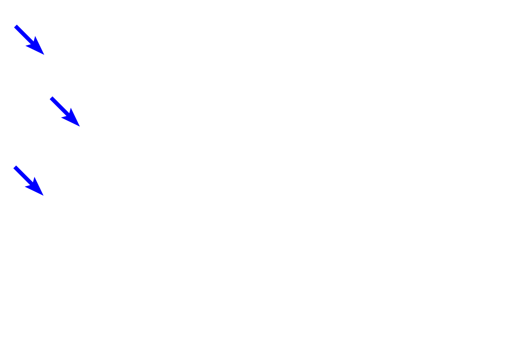 Interlobular connective tissue <p>Intralobular ducts are surrounded by glandular parenchyma and are lined by a cuboidal or columnar epithelium.  Interlobular ducts are lined by a stratified columnar epithelium and anastomose with each other to form the main duct(s) connecting to the epithelium onto which secretions are released. 200x</p>
