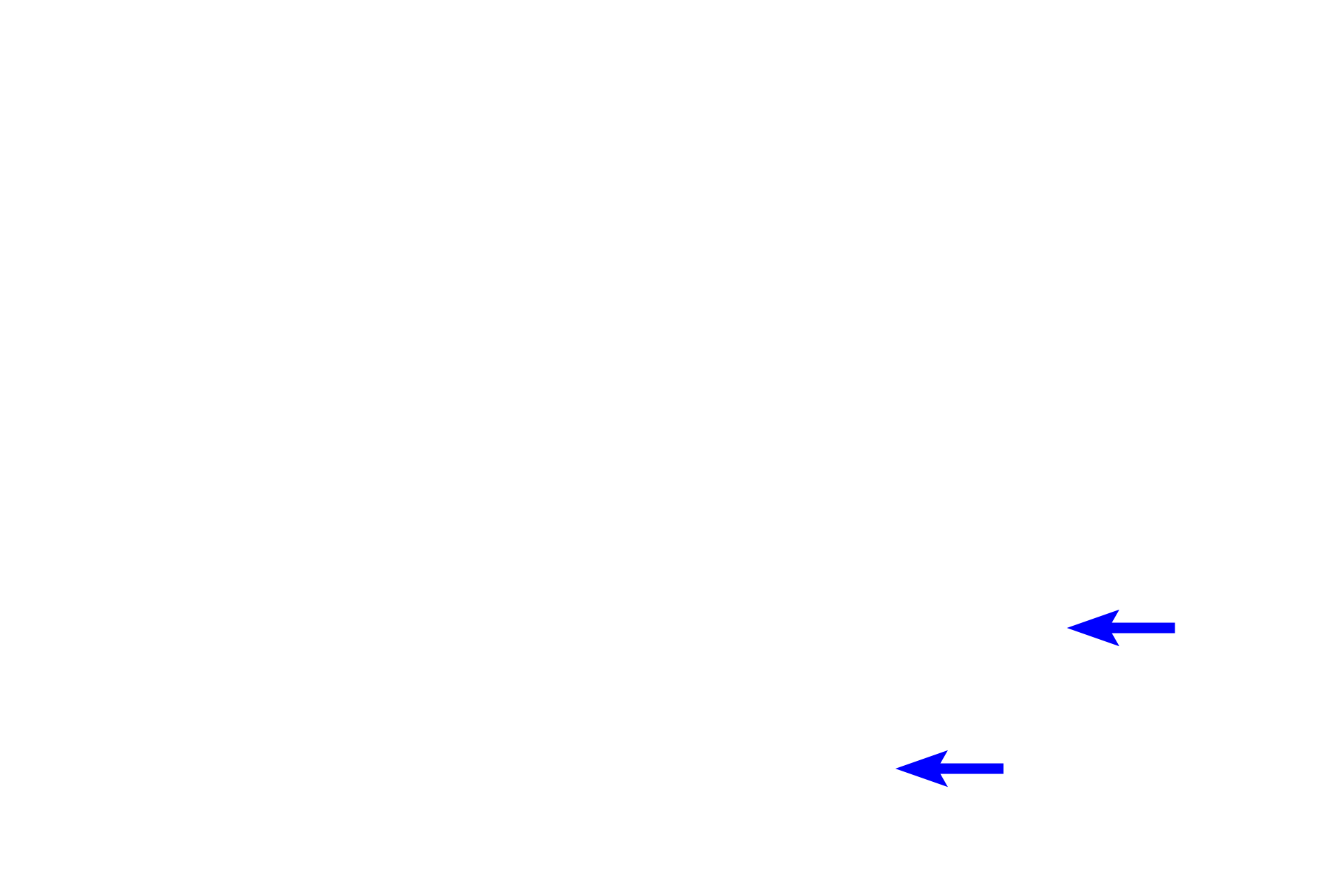  - Goblet cells <p>A  large interlobular duct is surrounded by dense interlobular connective tissue.  This duct forms by the coalescing of smaller intralobular ducts and will, in turn, drain into larger interlobular ducts to eventually form the main secretory duct of the gland.  This large interlobular duct is lined by a stratified columnar epithelium which also includes scattered goblet cells.  Parotid gland 400x</p>
