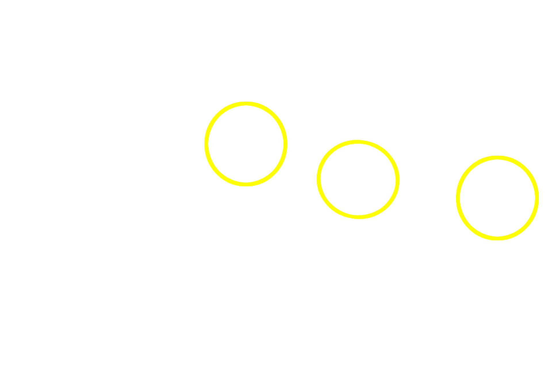 Acini <p>A compound acinar gland is composed entirely of acinar (alveolar) secretory units.  Each spherical acinus is composed of cells with prominent, spherical nuclei and numerous secretory granules.  The lumen of each acinus is very narrow, appropriate for the thin, watery secretion of the acinar cells.  Numerous intralobular ducts are also visible.  Parotid gland 400x</p>
