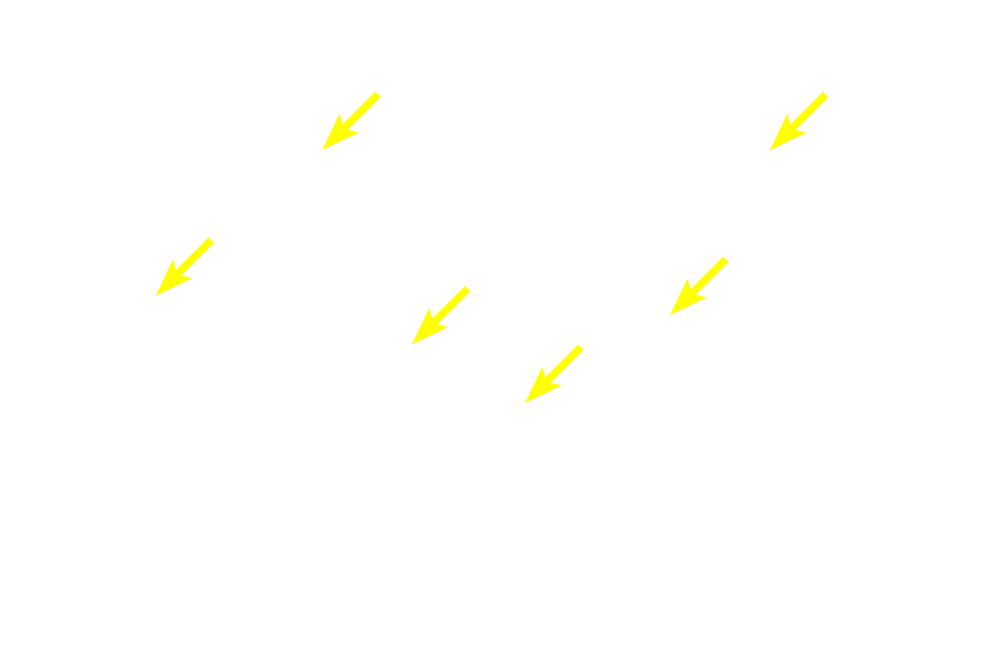  - Secretory granules <p>A compound acinar gland is composed entirely of acinar (alveolar) secretory units.  Each spherical acinus is composed of cells with prominent, spherical nuclei and numerous secretory granules.  The lumen of each acinus is very narrow, appropriate for the thin, watery secretion of the acinar cells.  Numerous intralobular ducts are also visible.  Parotid gland 400x</p>
