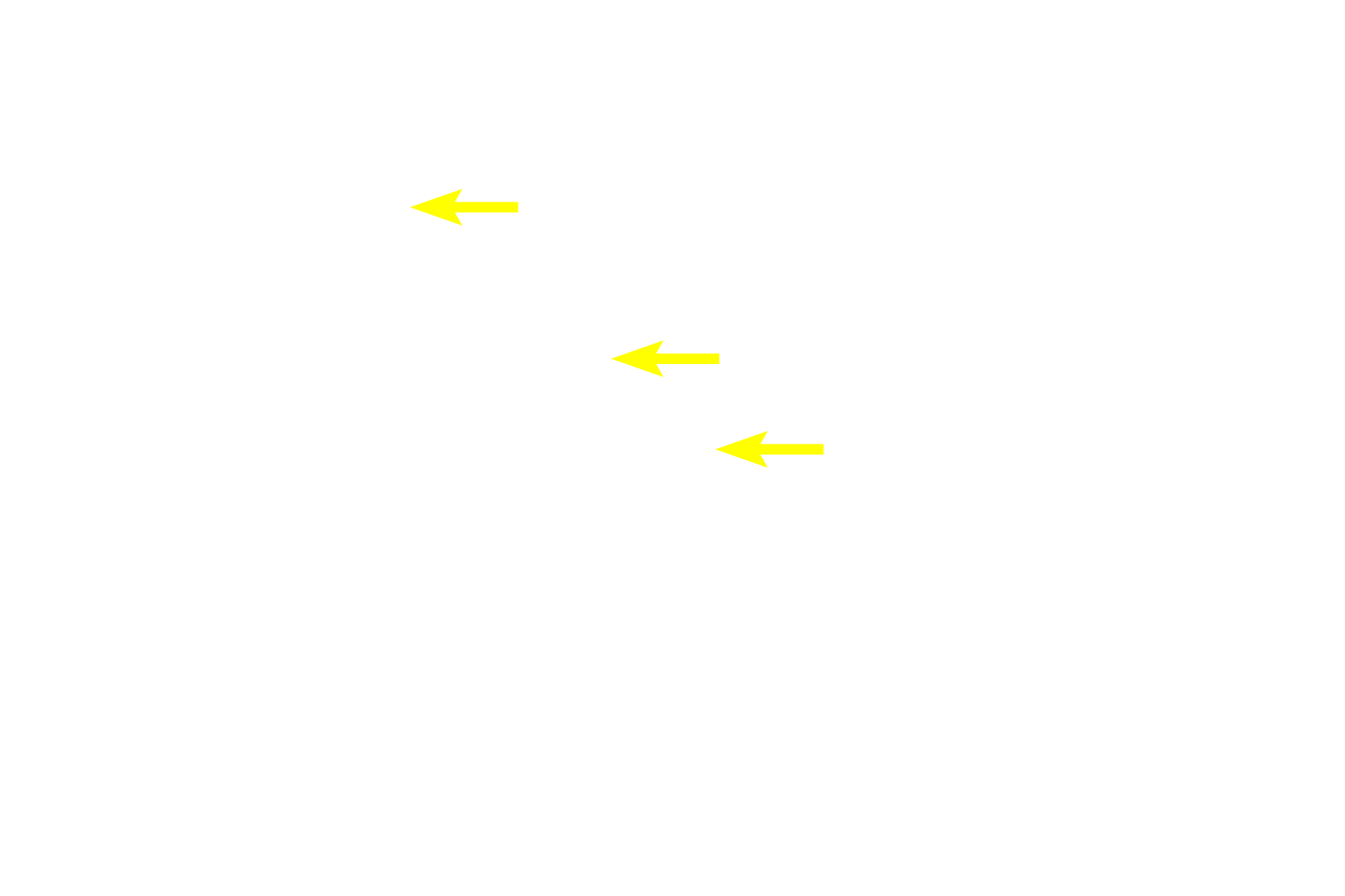  - Lumens of acini <p>A compound acinar gland is composed entirely of acinar (alveolar) secretory units.  Each spherical acinus is composed of cells with prominent, spherical nuclei and numerous secretory granules.  The lumen of each acinus is very narrow, appropriate for the thin, watery secretion of the acinar cells.  Numerous intralobular ducts are also visible.  Parotid gland 400x</p>
