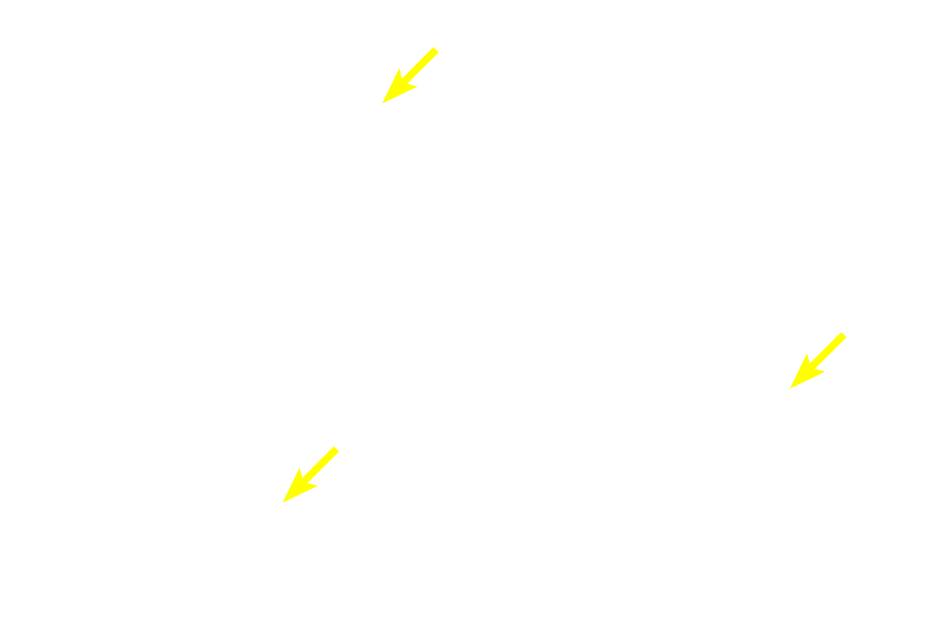 Intralobular ducts <p>A compound acinar gland is composed entirely of acinar (alveolar) secretory units.  Each spherical acinus is composed of cells with prominent, spherical nuclei and numerous secretory granules.  The lumen of each acinus is very narrow, appropriate for the thin, watery secretion of the acinar cells.  Numerous intralobular ducts are also visible.  Parotid gland 400x</p>
