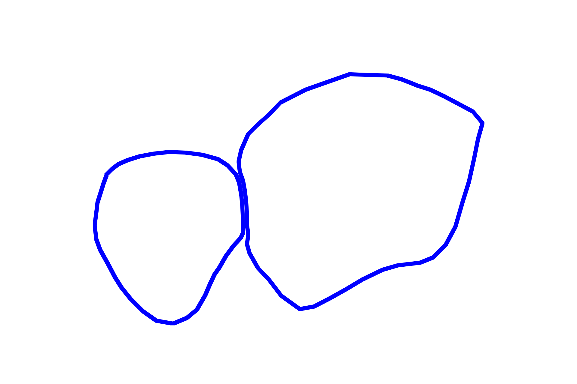 Acini <p>This compound acinar gland shows acini typically organized like a cluster of grapes.  Each acinus represents a single grape and the intralobular ducts represent the smallest stems.  The acinar cells are filled with zymogen (enzyme-containing) secretory granules.  Parotid gland 1000x</p>
