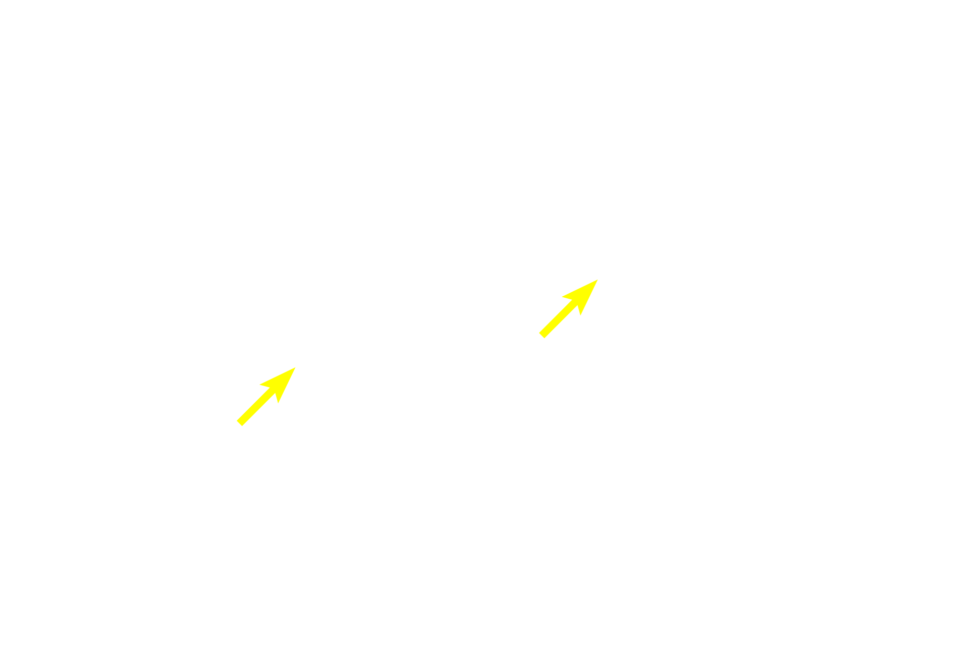  - Acinar lumens <p>This compound acinar gland shows acini typically organized like a cluster of grapes.  Each acinus represents a single grape and the intralobular ducts represent the smallest stems.  The acinar cells are filled with zymogen (enzyme-containing) secretory granules.  Parotid gland 1000x</p>

