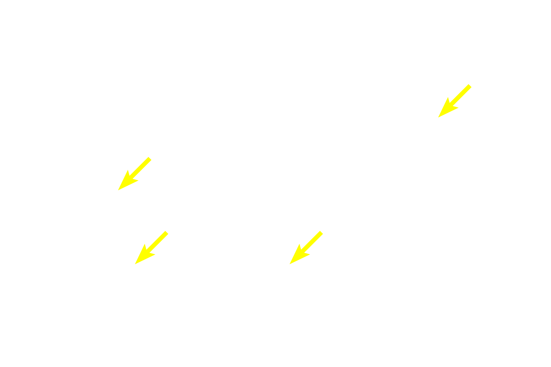  - Acinar cell nuclei <p>This compound acinar gland shows acini typically organized like a cluster of grapes.  Each acinus represents a single grape and the intralobular ducts represent the smallest stems.  The acinar cells are filled with zymogen (enzyme-containing) secretory granules.  Parotid gland 1000x</p>
