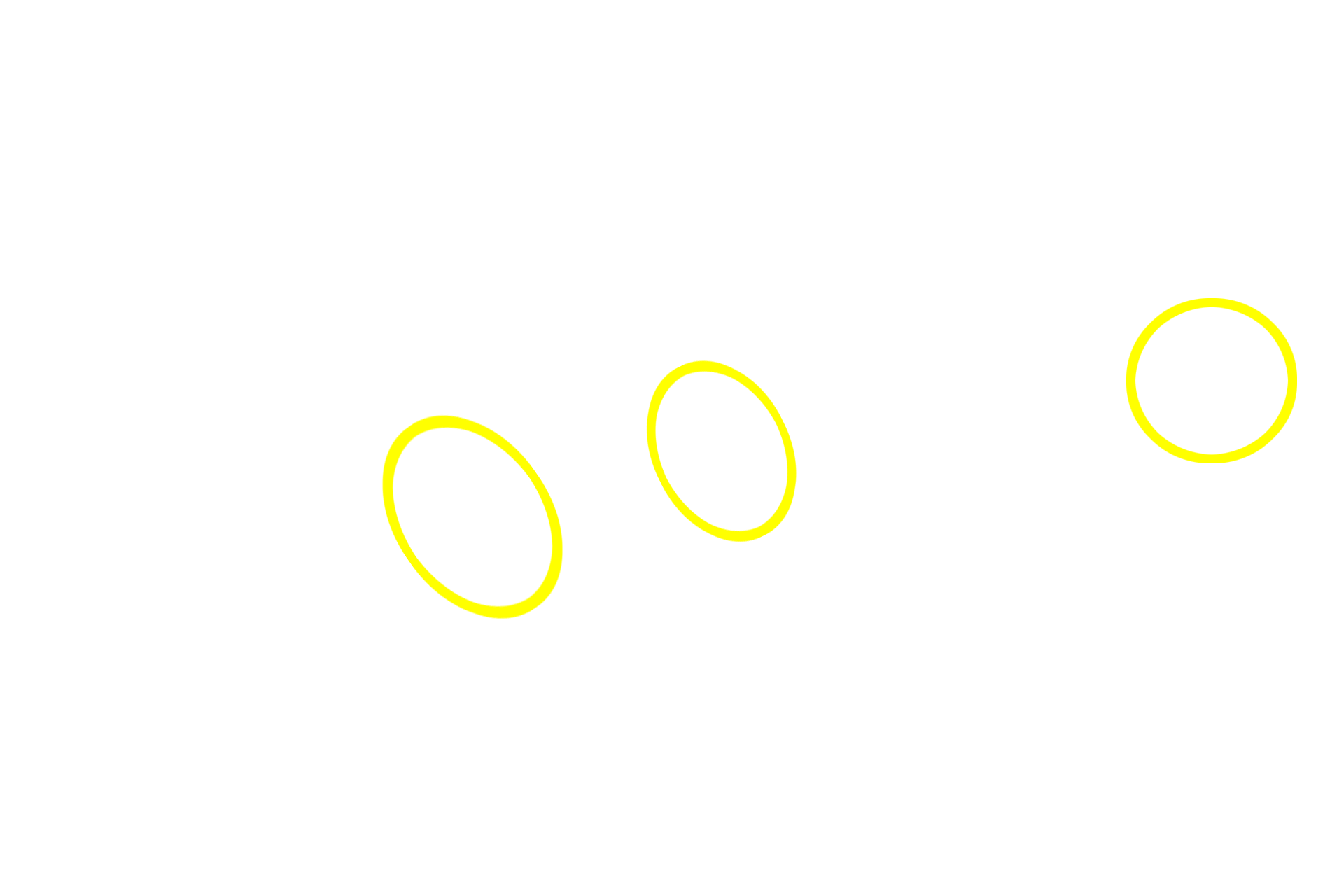 Acini <p>The pancreas is another example of a compound acinar gland.  Like the parotid gland, the acini are spherical, with wedge-shaped cells.  The cells accumulate eosinophilic secretory granules in their apices and display prominent basophilic rough endoplasmic reticulum at their bases.  The compound duct system is also visible in this image.  Pancreas  400x</p>
