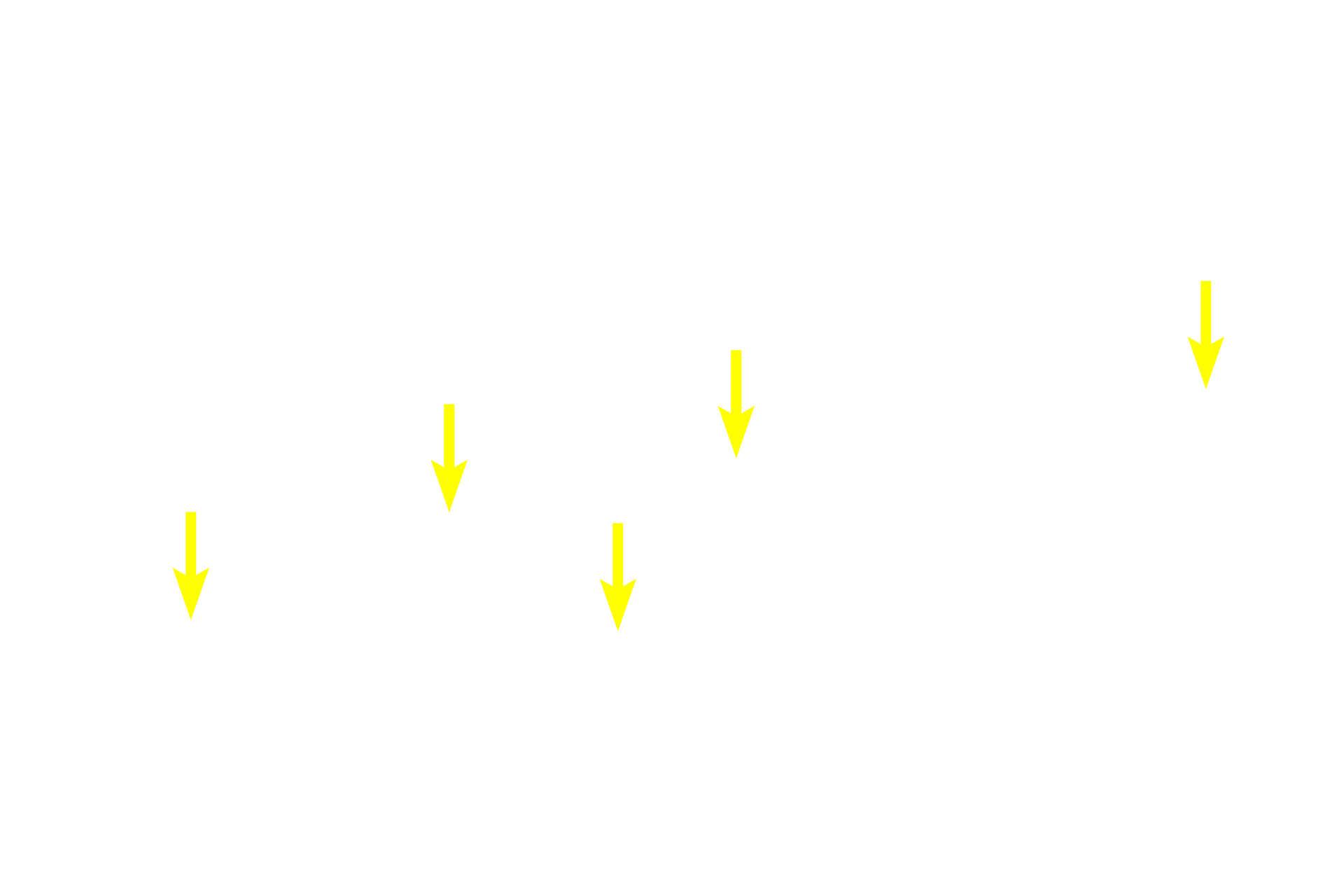  - Secretory granules <p>The pancreas is another example of a compound acinar gland.  Like the parotid gland, the acini are spherical, with wedge-shaped cells.  The cells accumulate eosinophilic secretory granules in their apices and display prominent basophilic rough endoplasmic reticulum at their bases.  The compound duct system is also visible in this image.  Pancreas  400x</p>
