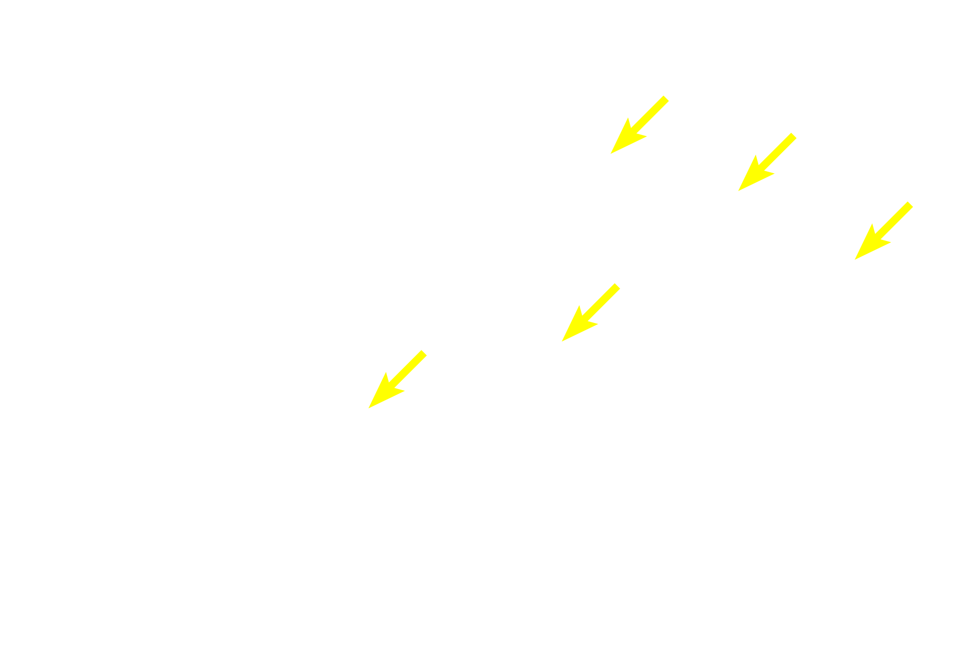  - Nuclei of secretory cells <p>The pancreas is another example of a compound acinar gland.  Like the parotid gland, the acini are spherical, with wedge-shaped cells.  The cells accumulate eosinophilic secretory granules in their apices and display prominent basophilic rough endoplasmic reticulum at their bases.  The compound duct system is also visible in this image.  Pancreas  400x</p>
