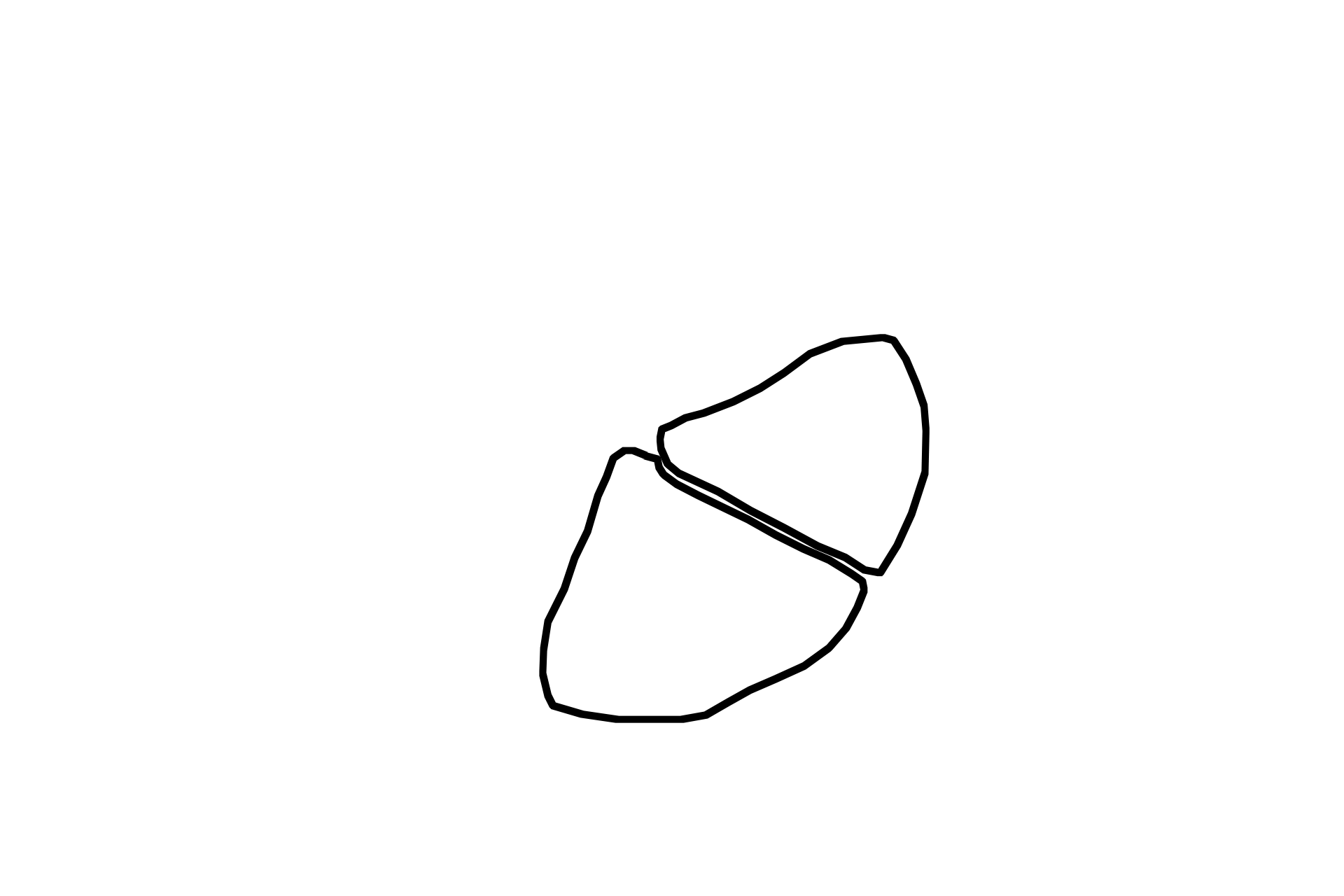  - Acinar cells <p>Exocrine cells are polarized to secrete toward an epithelial surface.  Basal rough endoplasmic reticulum synthesizes proteins that are packaged as secretory granules located in the apex of each cell.  Contents of secretory granules are released into the acinar lumen by the merocrine mode of secretion.  Pancreas  1000x</p>
