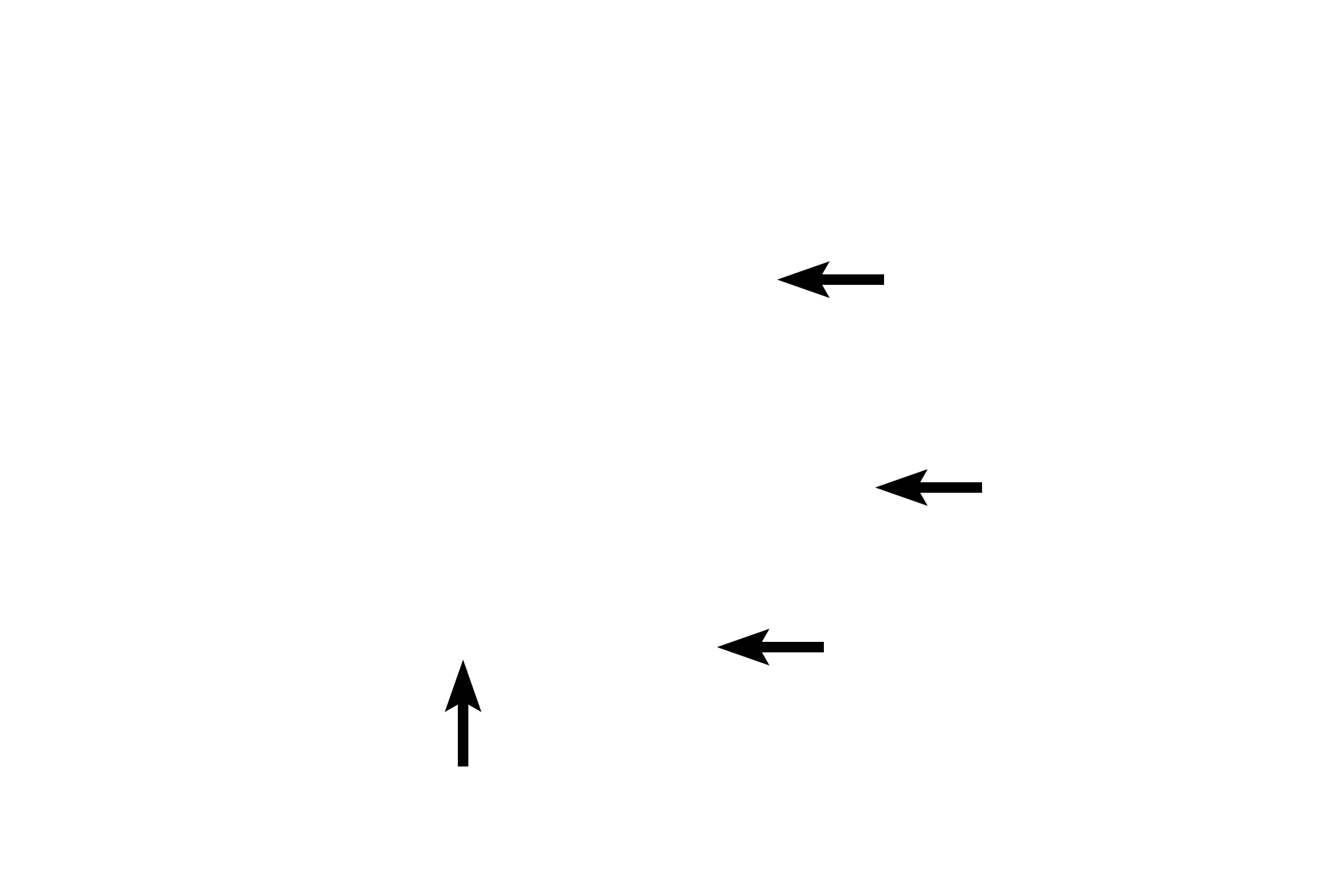  - RER <p>Exocrine cells are polarized to secrete toward an epithelial surface.  Basal rough endoplasmic reticulum synthesizes proteins that are packaged as secretory granules located in the apex of each cell.  Contents of secretory granules are released into the acinar lumen by the merocrine mode of secretion.  Pancreas  1000x</p>
