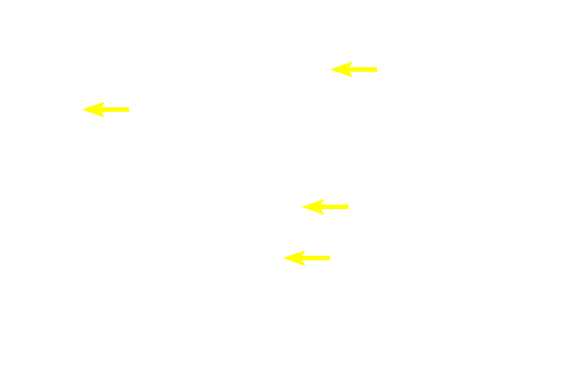 Mucin granules <p>This sheet gland, consists entirely of mucus-secreting cells.  The nucleus of each of these columnar cells is located just beneath the mucin.  Stomach  1000x</p>
