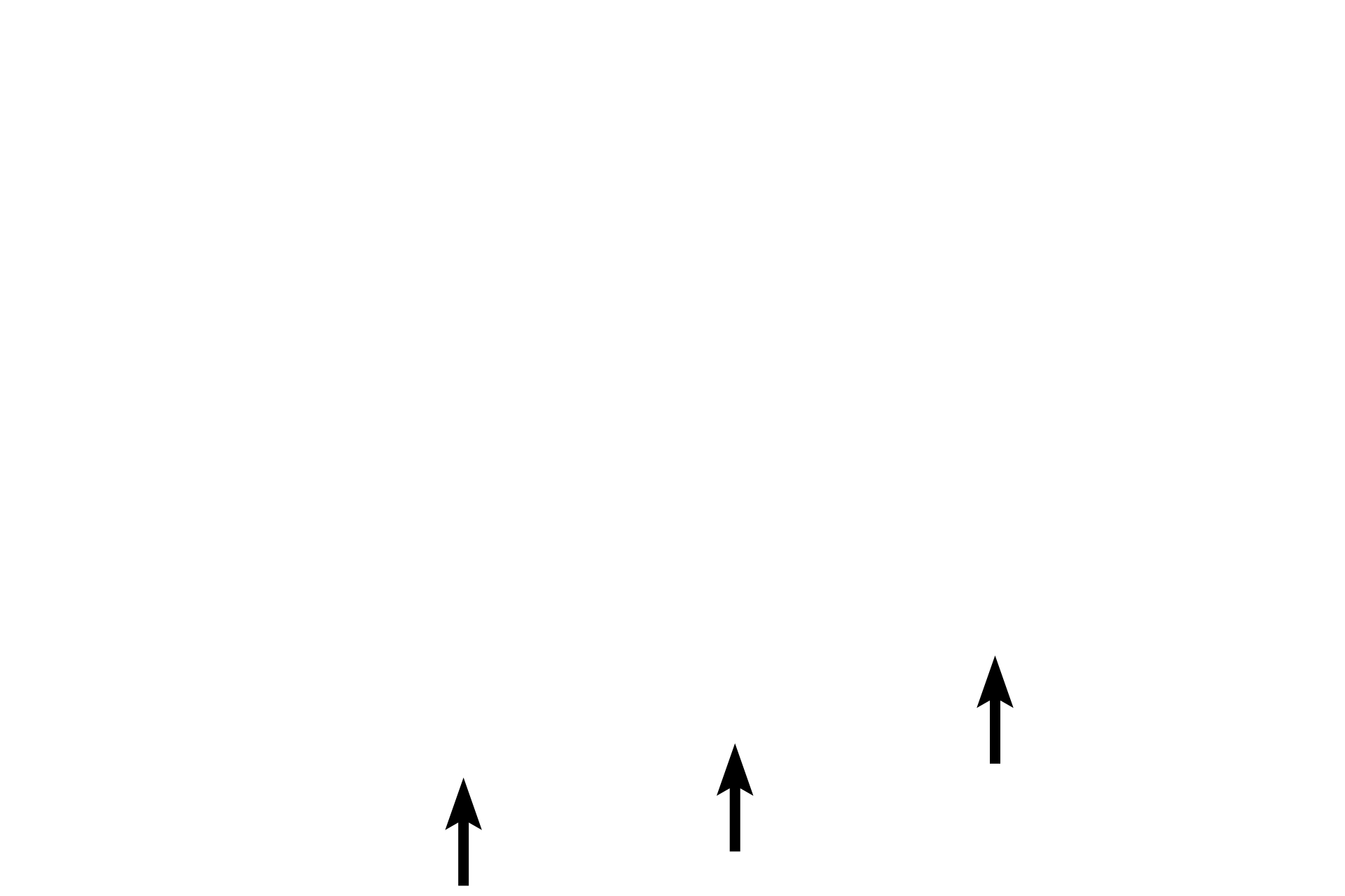 Inner eyelid skin <p>In addition to a tubular configuration, the secretory units of a simple gland can also be acinar.  This example shows a gland with an unbranched duct into which the acini (alveoli) release their secretory product.  This is a Meibomian gland (tarsal gland) and is located in the eyelid.  It secretes an oily material by the holocrine mode of secretion that covers the watery tear film layer on the surface of the eye to prevent drying.  Eyelid 100x</p>
