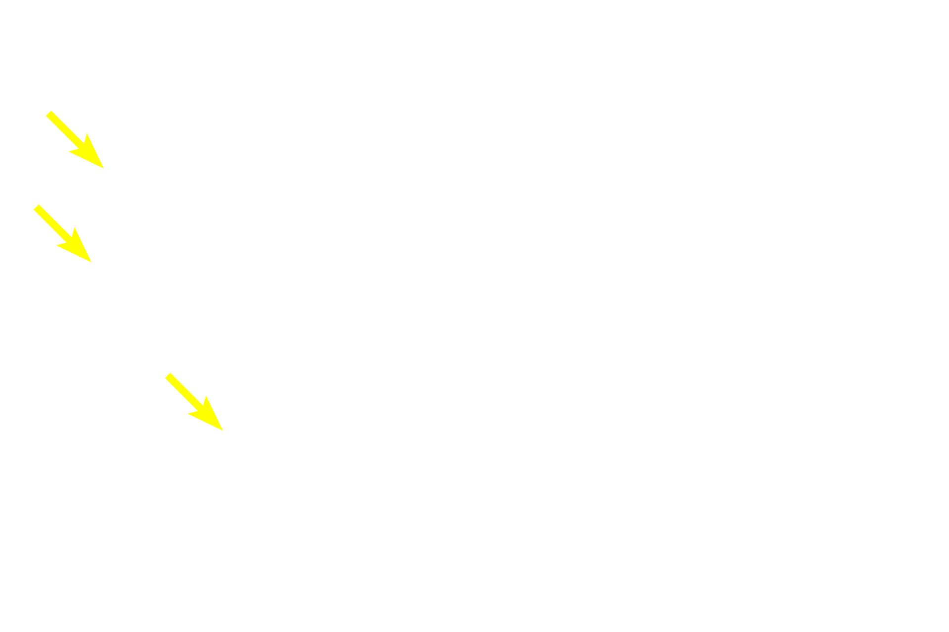  - Proliferative cells <p>Each sebaceous gland is composed of multiple acini attached to a single, unbranched duct.  Several glands are pictured here.  The secretory product, sebum, is composed of a mixture of lipids, that accumulate in the cells as they progress from the periphery to the center of the acinus.  Cells are secreted in their entirety or rupture their contents into the hair follicle.  200x</p>
