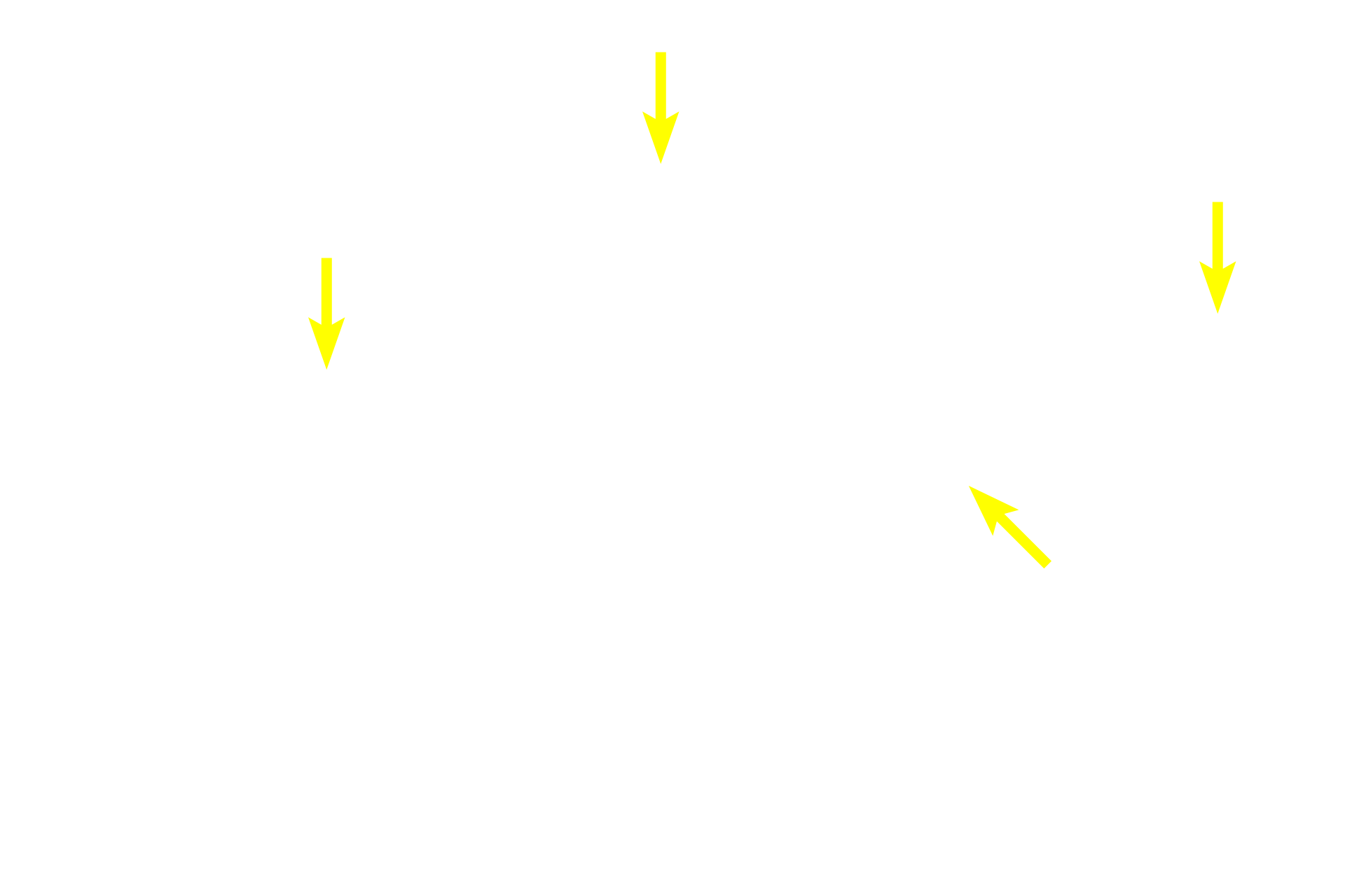Proliferative cells <p>The acinus of this sebaceous gland is associated with a hair follicle.  The gland releases its product by the holocrine mode of secretion.  Cells at the periphery proliferate and move toward the center of the acinus as they accumulate their secretory product and degenerate.  The whole cell or its entire contents are released onto the hair follicle as sebum.  Skin  400x</p>

