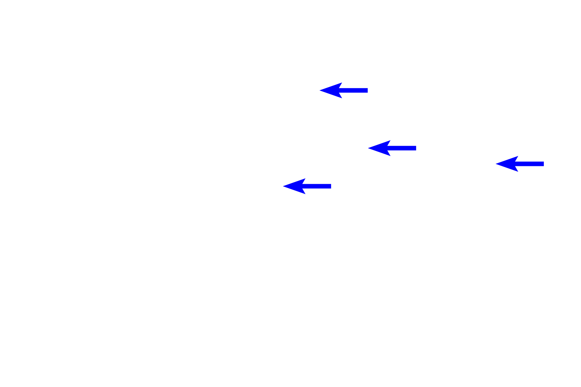  - Gland lumens <p>Simple tubular glands resemble test tubes.  Each gland forms a single, unbranched tubule that is directly connected to the overlying epithelium.  Tubular glands in which a duct is absent, as in this case, or is unbranched, are both classified as simple.  These glands, named intestinal glands, are composed primarily of goblet and absorptive cells and are located in the small and large intestines.  Colon 200x</p>
