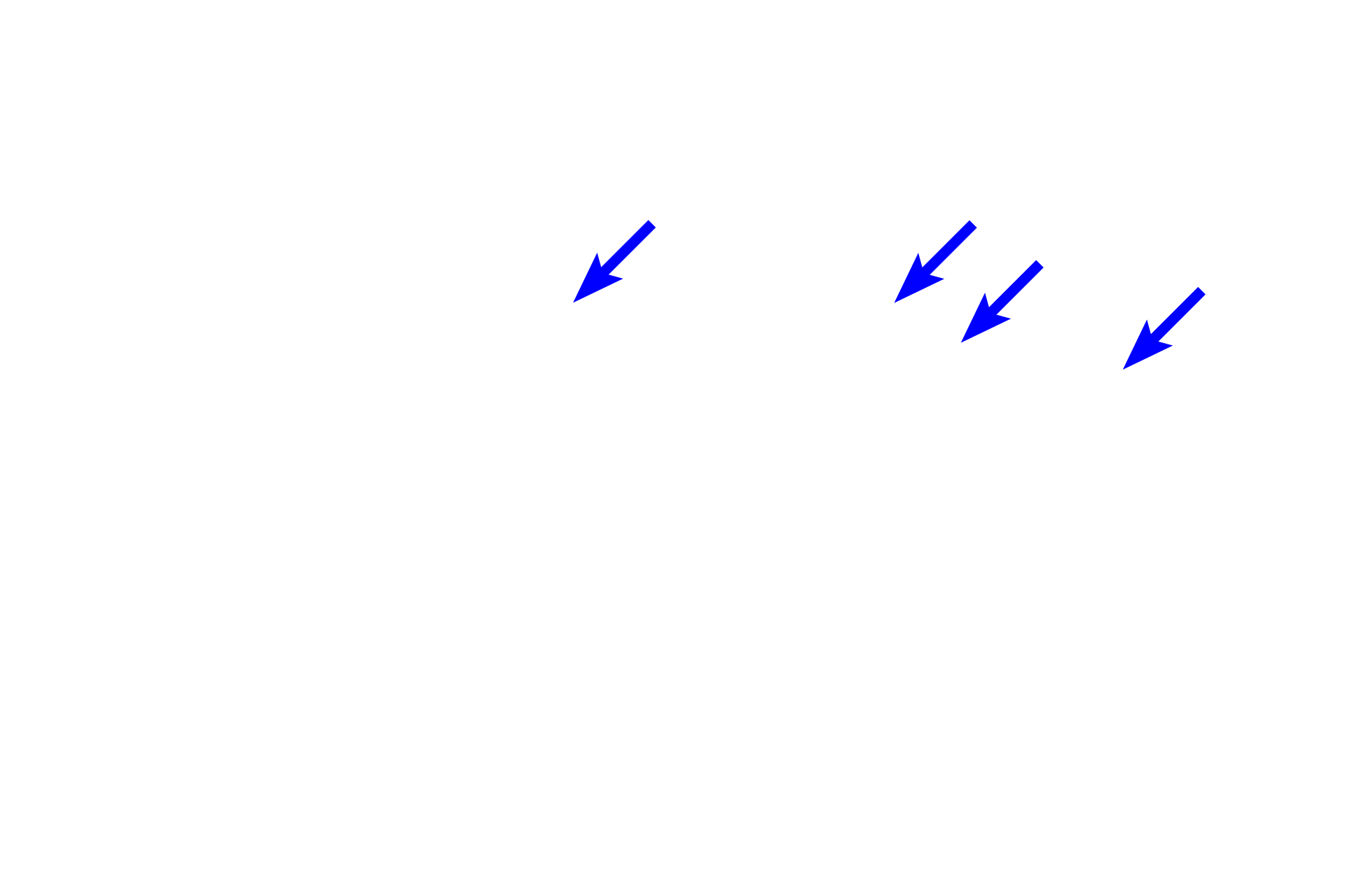  - Goblet cells <p>Simple tubular glands resemble test tubes.  Each gland forms a single, unbranched tubule that is directly connected to the overlying epithelium.  Tubular glands in which a duct is absent, as in this case, or is unbranched, are both classified as simple.  These glands, named intestinal glands, are composed primarily of goblet and absorptive cells and are located in the small and large intestines.  Colon 200x</p>
