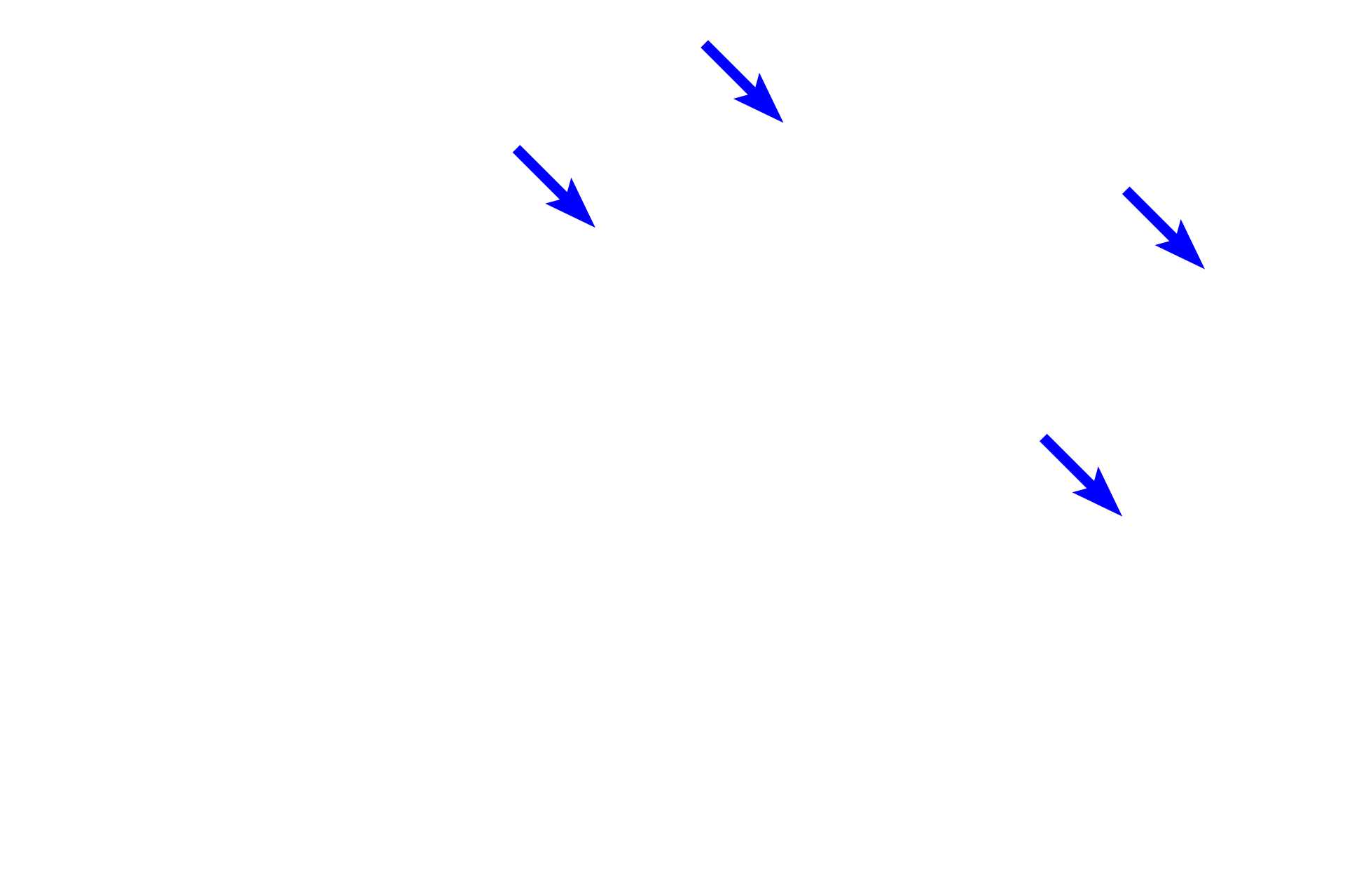  - Absorptive cells <p>Simple tubular glands resemble test tubes.  Each gland forms a single, unbranched tubule that is directly connected to the overlying epithelium.  Tubular glands in which a duct is absent, as in this case, or is unbranched, are both classified as simple.  These glands, named intestinal glands, are composed primarily of goblet and absorptive cells and are located in the small and large intestines.  Colon 200x</p>

