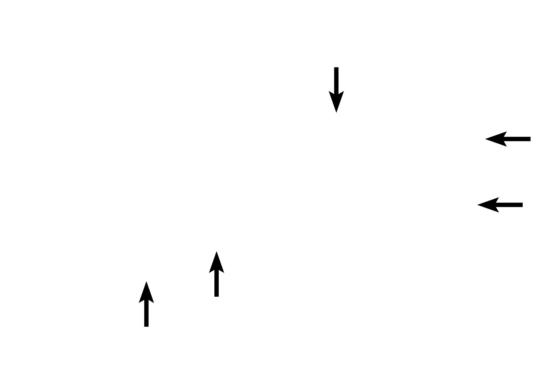 Secretory tubules <p>The secretory portions of two simple, coiled tubular glands are shown in this image.  Here, the more lightly stained secretory portions of the gland coil along with the terminal end of the duct, which is more darkly stained.  Because the gland is highly coiled, multiple sections though the tube are visible.  The secretory portion of the gland is continuous with its duct, which initially coils along with the secretory portion.  The duct then straightens out and continues to the surface of the skin.  Skin 200x</p>
