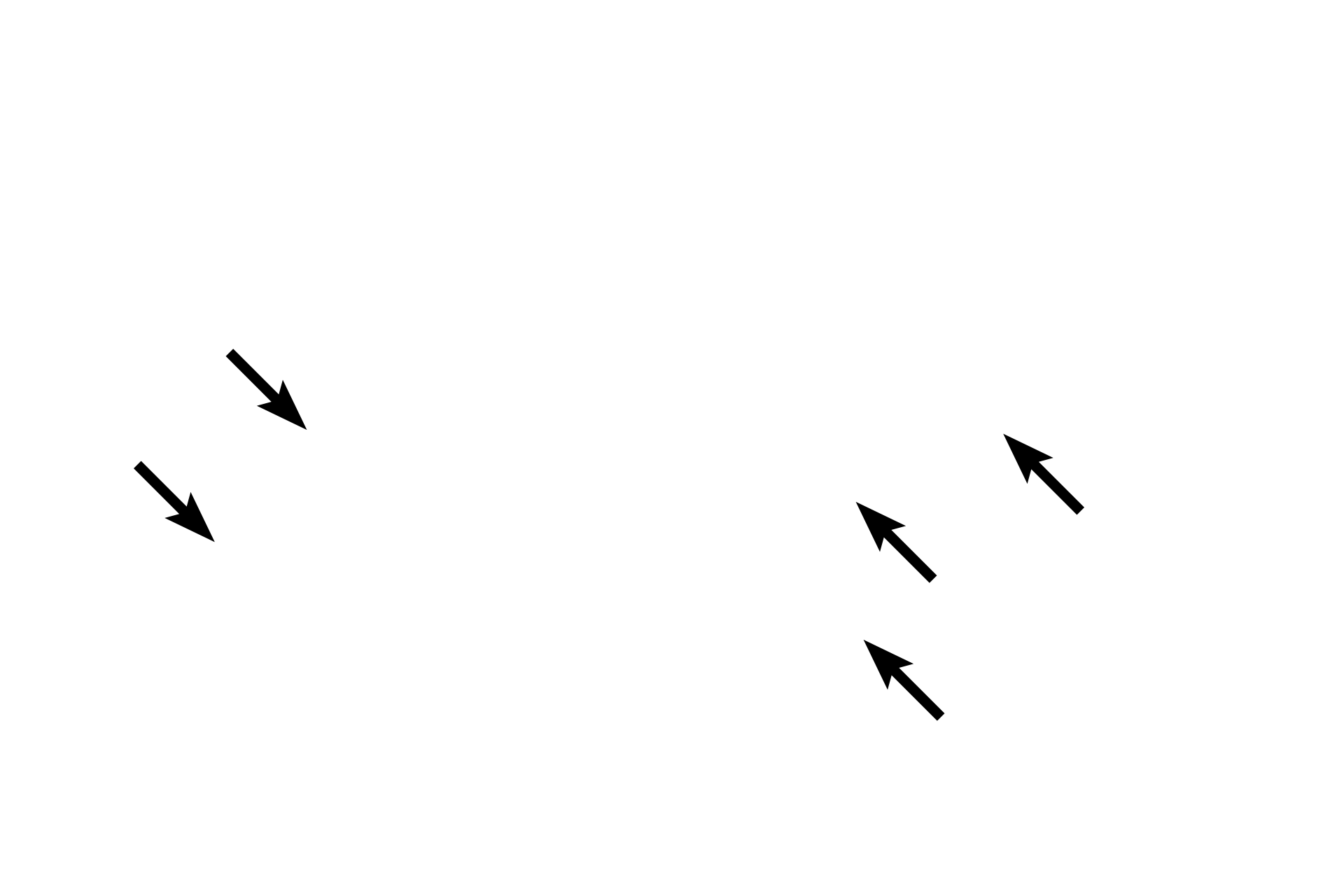 Ducts <p>The secretory portions of two simple, coiled tubular glands are shown in this image.  Here, the more lightly stained secretory portions of the gland coil along with the terminal end of the duct, which is more darkly stained.  Because the gland is highly coiled, multiple sections though the tube are visible.  The secretory portion of the gland is continuous with its duct, which initially coils along with the secretory portion.  The duct then straightens out and continues to the surface of the skin.  Skin 200x</p>
