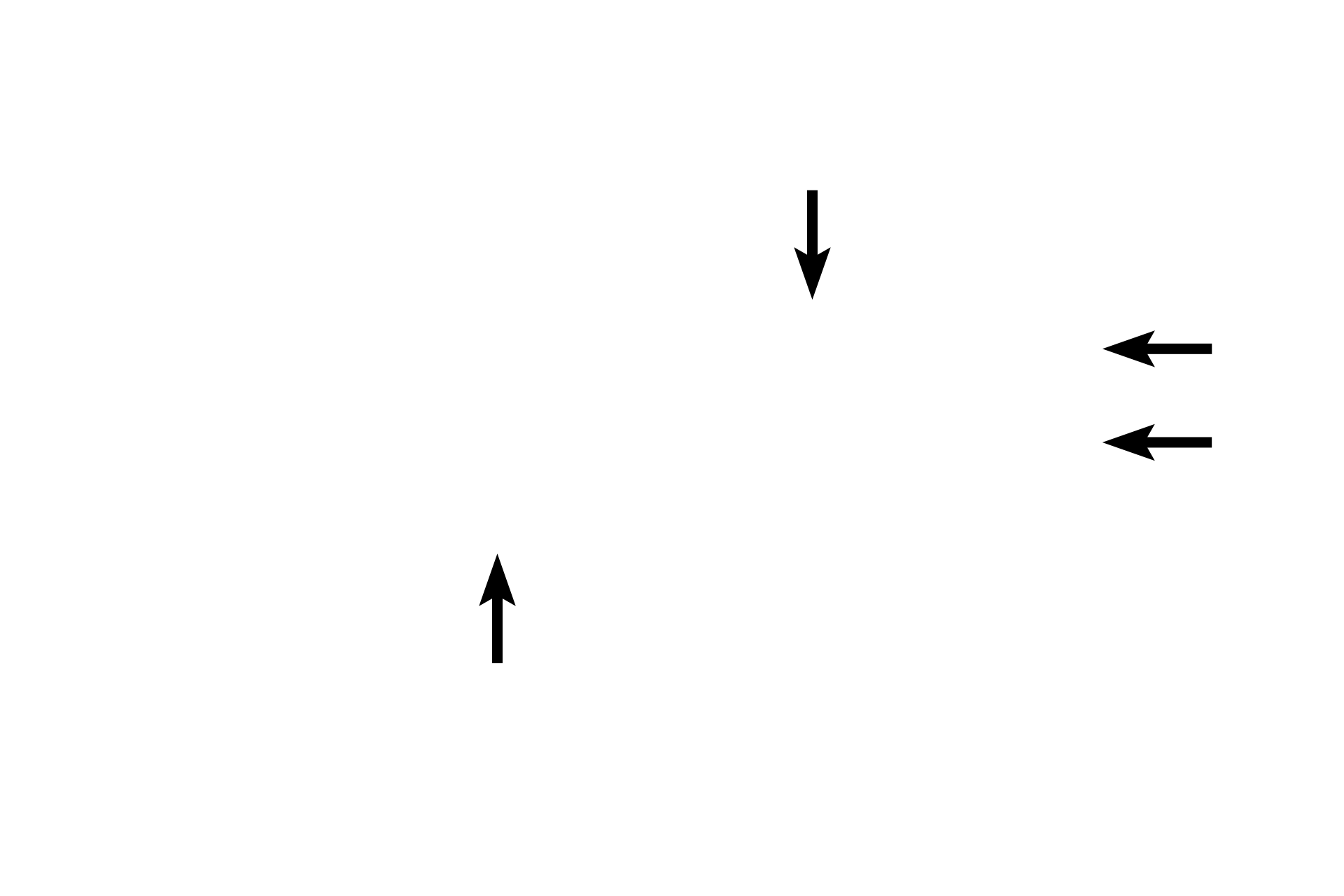  - Gland lumens <p>The secretory portions of two simple, coiled tubular glands are shown in this image.  Here, the more lightly stained secretory portions of the gland coil along with the terminal end of the duct, which is more darkly stained.  Because the gland is highly coiled, multiple sections though the tube are visible.  The secretory portion of the gland is continuous with its duct, which initially coils along with the secretory portion.  The duct then straightens out and continues to the surface of the skin.  Skin 200x</p>
