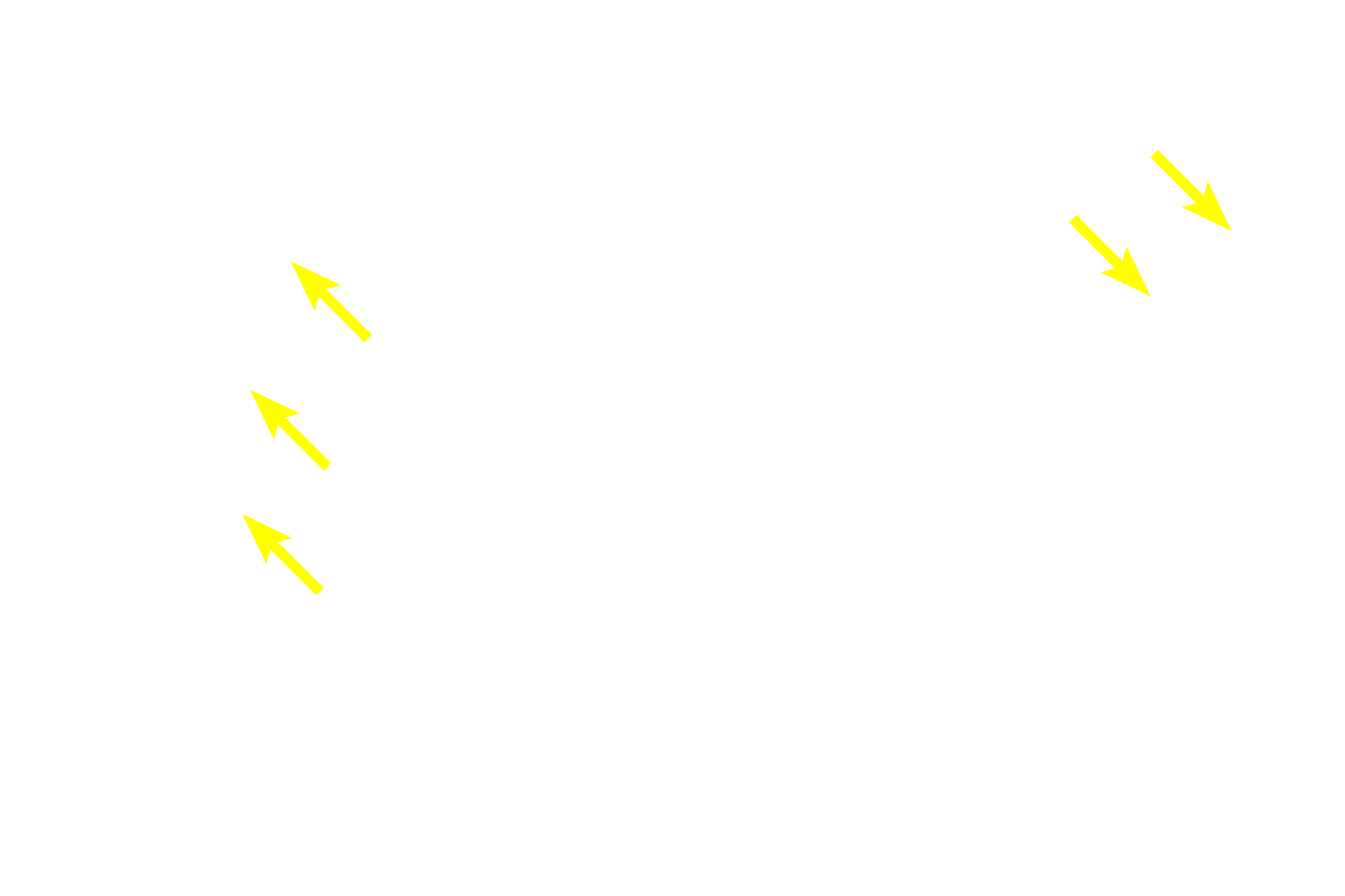 Hair follicles <p>A second type of simple coiled tubular gland is the apocrine sweat gland.  These glands produce a thicker secretory product than eccrine sweat glands and thus possess wider lumens.  The ducts of apocrine glands open into hair follicles near those of the sebaceous glands.  Apocrine sweat glands are located in the anal (shown here) and axillary regions.  They are also present in the nipple of the breast.  Anus 100x</p>

