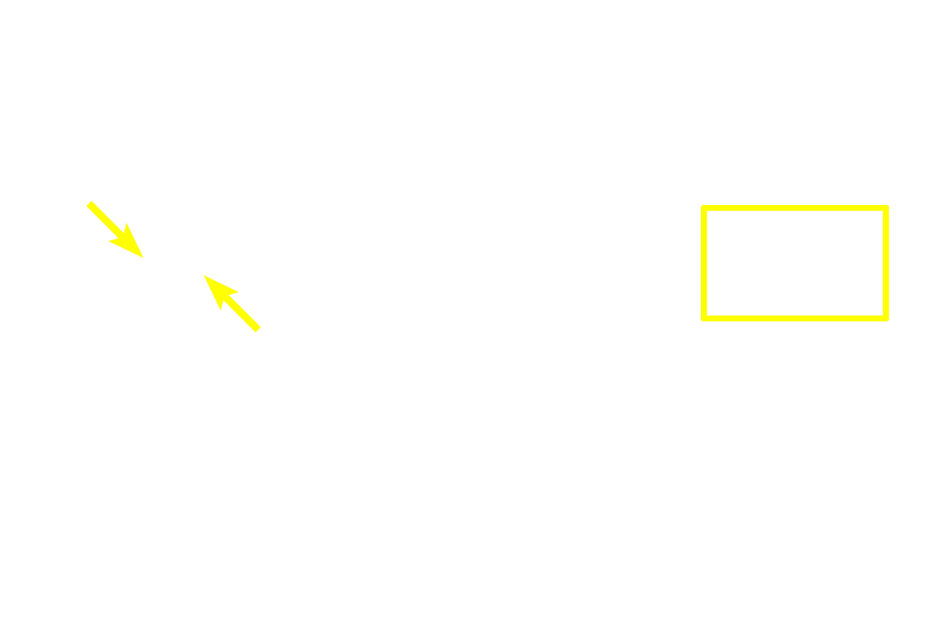 Sebaceous glands <p>A second type of simple coiled tubular gland is the apocrine sweat gland.  These glands produce a thicker secretory product than eccrine sweat glands and thus possess wider lumens.  The ducts of apocrine glands open into hair follicles near those of the sebaceous glands.  Apocrine sweat glands are located in the anal (shown here) and axillary regions.  They are also present in the nipple of the breast.  Anus 100x</p>
