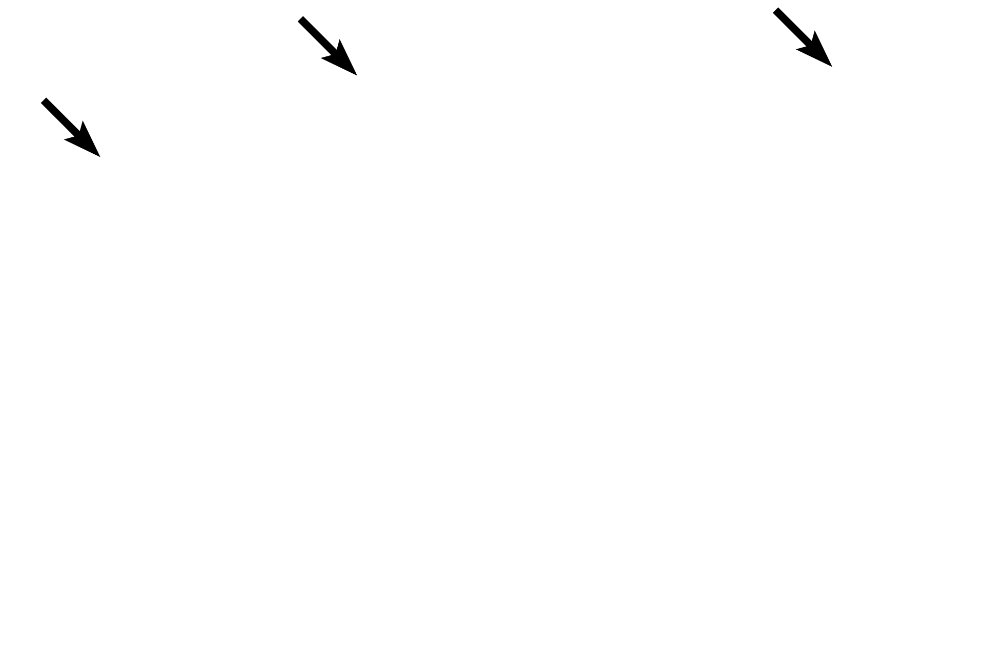 Epidermis of the skin <p>A second type of simple coiled tubular gland is the apocrine sweat gland.  These glands produce a thicker secretory product than eccrine sweat glands and thus possess wider lumens.  The ducts of apocrine glands open into hair follicles near those of the sebaceous glands.  Apocrine sweat glands are located in the anal (shown here) and axillary regions.  They are also present in the nipple of the breast.  Anus 100x</p>
