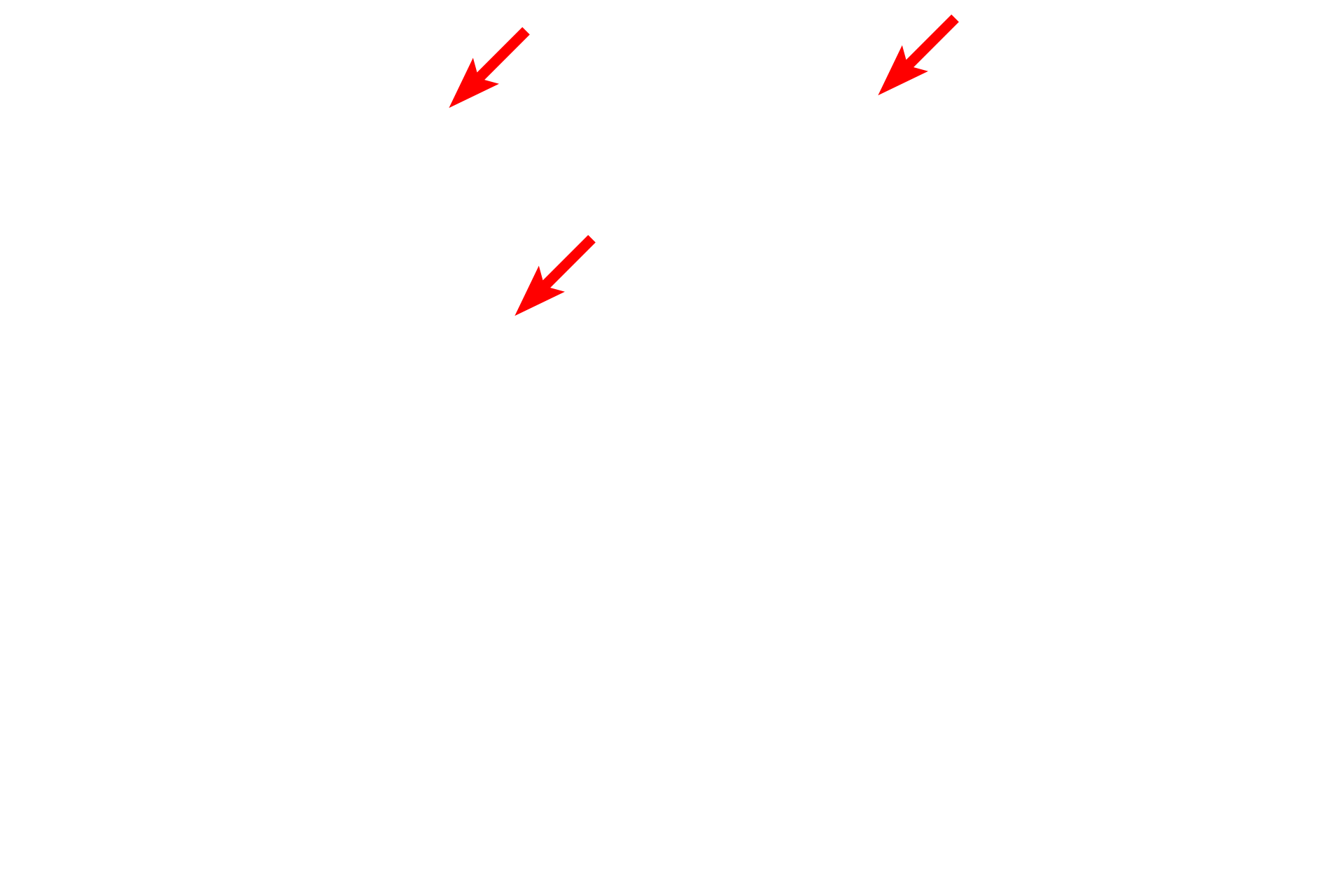  - Cilia <p>This lining epithelium of the trachea is a pseudostratified epithelium with cilia and goblet cells.  Goblet cells release mucin proteins which become hydrated, thereby forming mucus.  The mucus traps inhaled particles and the entire mucous sheet is moved upward by the beating action of the cilia.  1000x</p>
