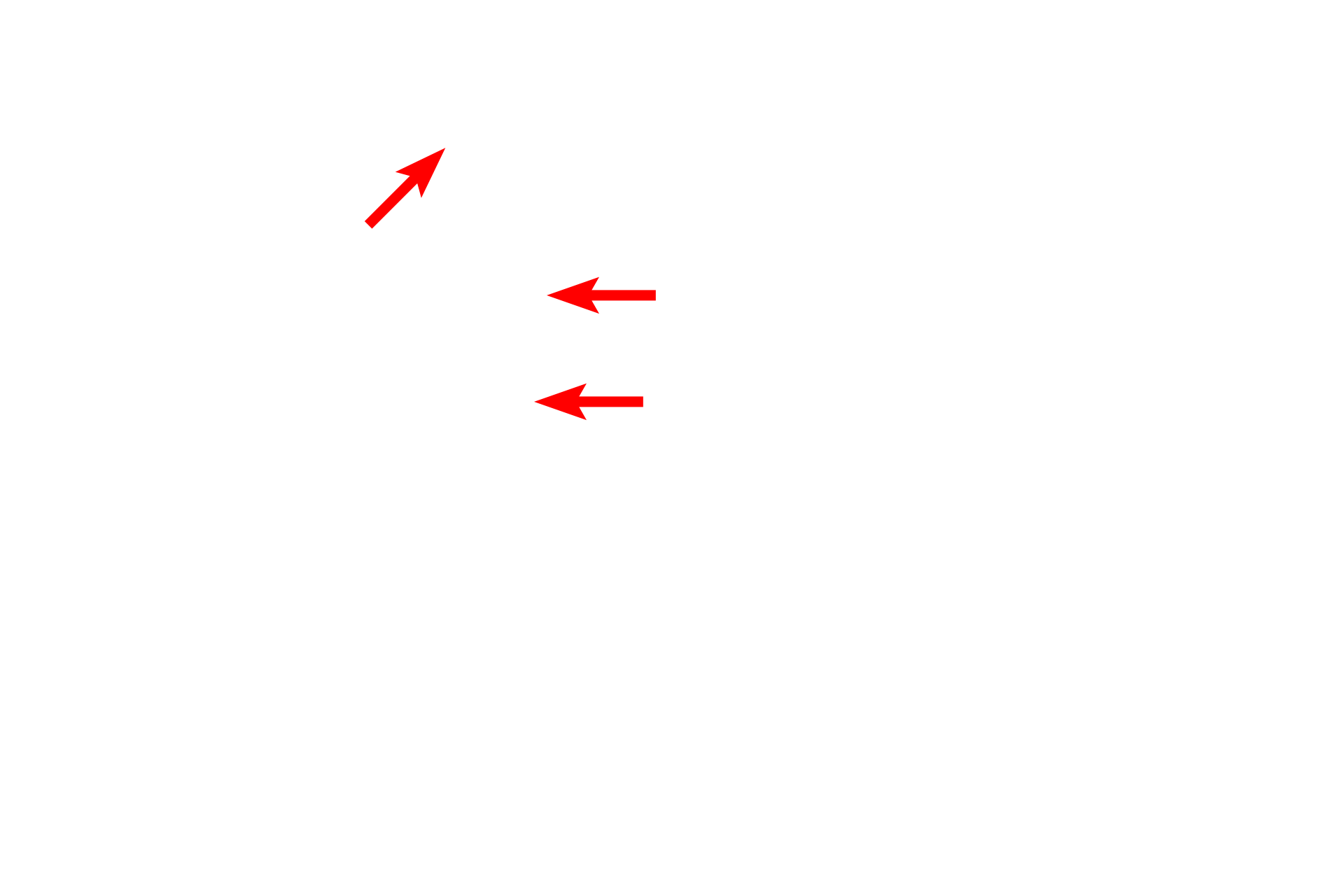  - Basal bodies <p>This lining epithelium of the trachea is a pseudostratified epithelium with cilia and goblet cells.  Goblet cells release mucin proteins which become hydrated, thereby forming mucus.  The mucus traps inhaled particles and the entire mucous sheet is moved upward by the beating action of the cilia.  1000x</p>
