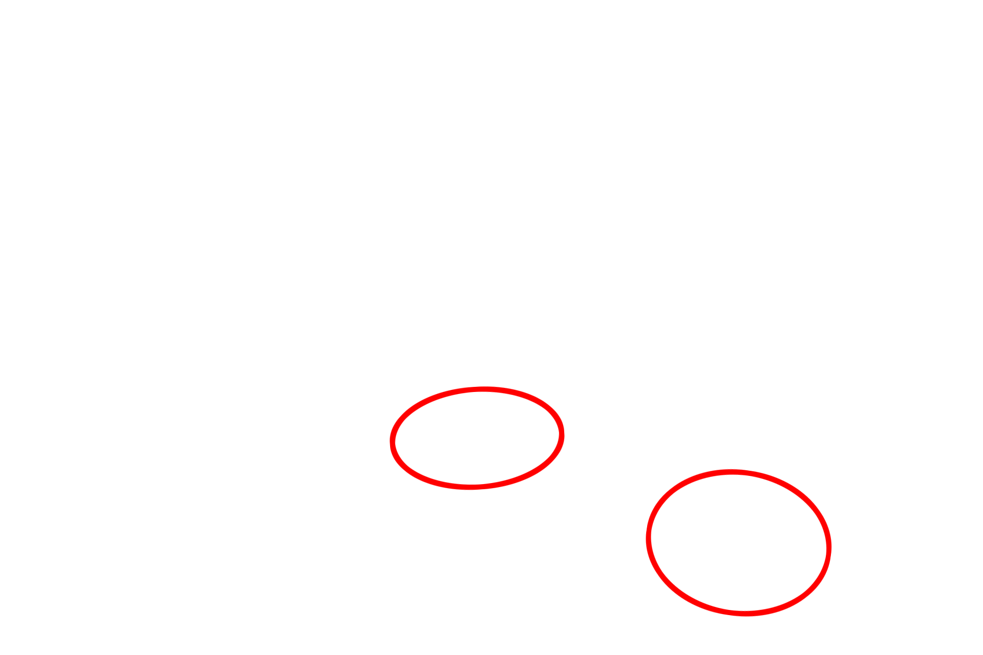  - Mucin granules <p>This electron micrograph shows the apex of a goblet cell filled with mucin granules.  The goblet cell is flanked by non-secretory, ciliated cells of the respiratory epithelium.  The mucin granules contain highly glycosylated proteins which become hydrated after release, thereby forming mucus.  14,000x</p>
