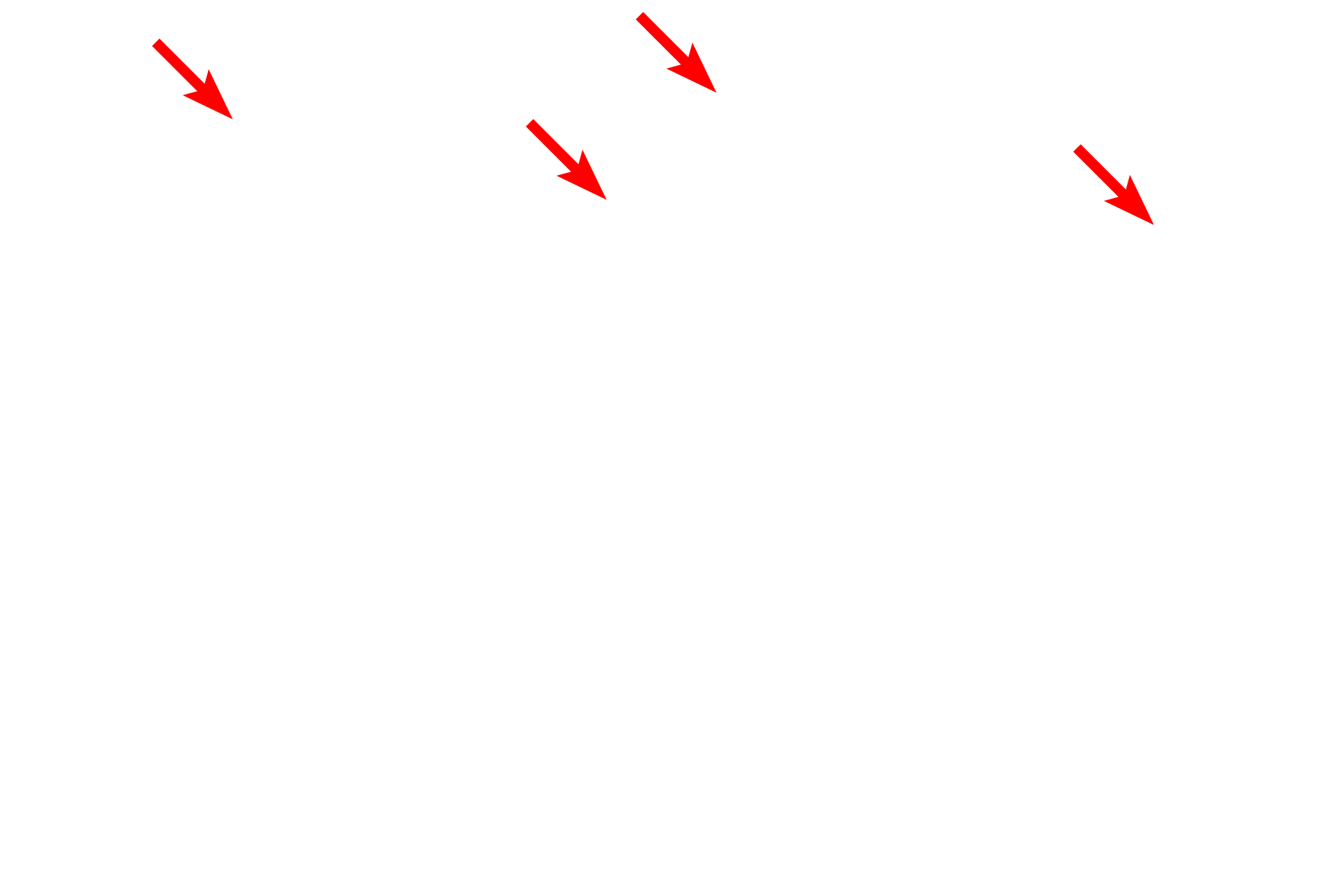 Cilia <p>This electron micrograph shows the apex of a goblet cell filled with mucin granules.  The goblet cell is flanked by non-secretory, ciliated cells of the respiratory epithelium.  The mucin granules contain highly glycosylated proteins which become hydrated after release, thereby forming mucus.  14,000x</p>
