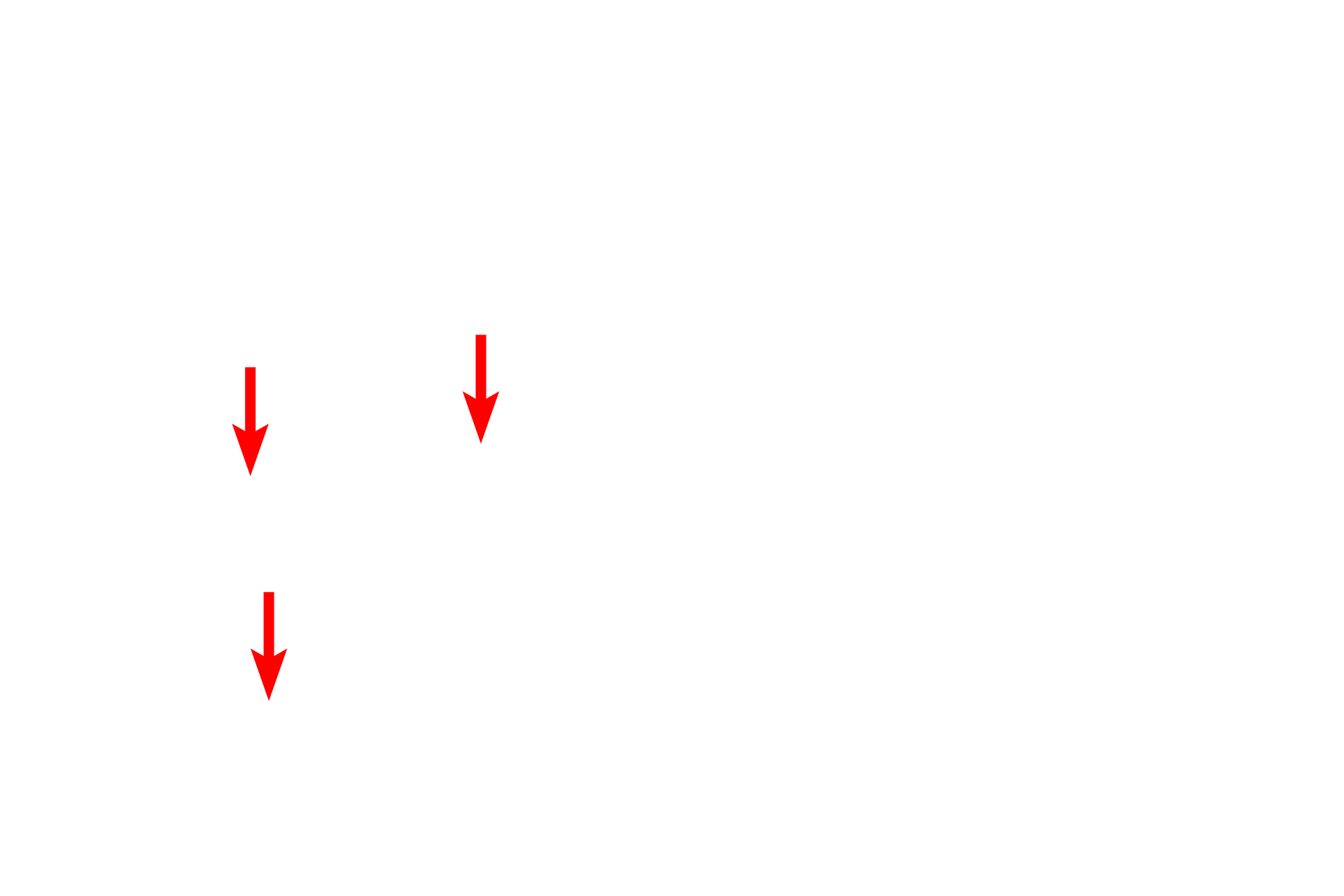 Mitochondria <p>This electron micrograph shows the apex of a goblet cell filled with mucin granules.  The goblet cell is flanked by non-secretory, ciliated cells of the respiratory epithelium.  The mucin granules contain highly glycosylated proteins which become hydrated after release, thereby forming mucus.  14,000x</p>
