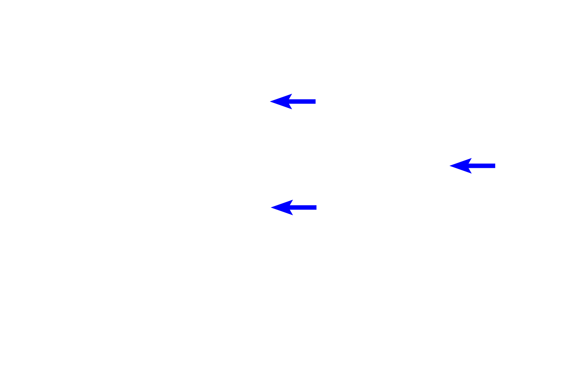  -- Secretory granules <p>Exocrine glands release their secretory products by one of three modes of secretion, merocrine, apocrine or holocrine. These pancreatic acinar cells utilize the merocrine mode of secretion. During this process, enzyme-containing secretory granules accumulate at the apex of the cell, fuse with the plasma membrane and discharge their contents by exocytosis into the lumen. No extra-granular cellular contents are lost. 1200x</p>
